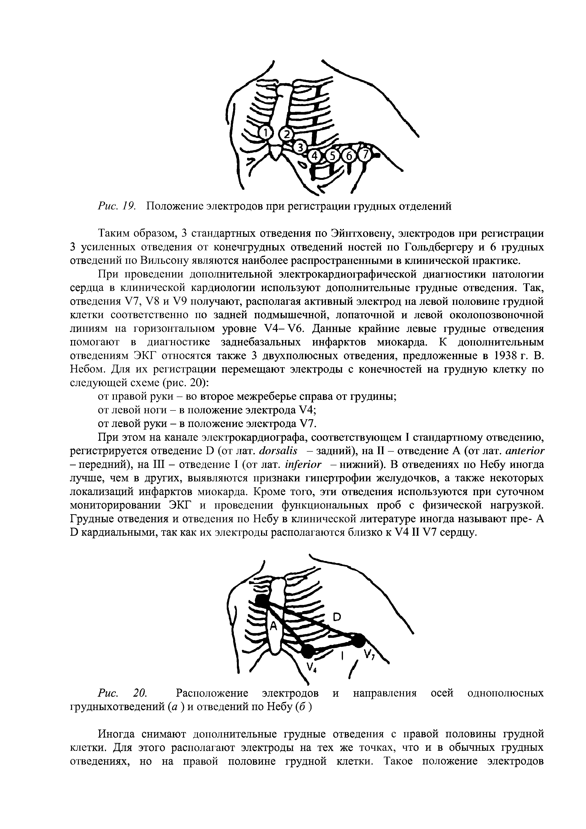 Рис. 20. Расположение электродов и направления грудныхотведений (а ) и отведений по Небу (б)...