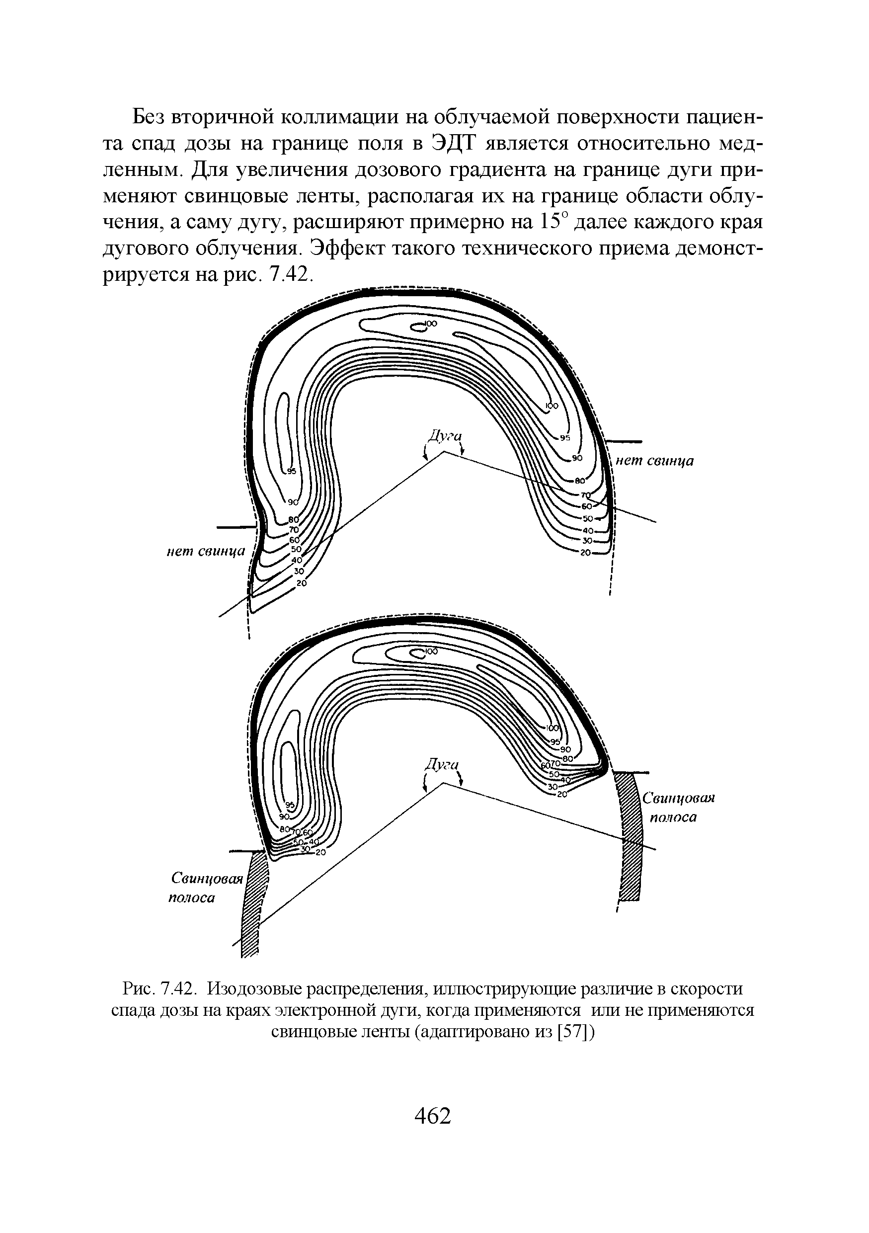 Рис. 7.42. Изодозовые распределения, иллюстрирующие различие в скорости спада дозы на краях электронной дуги, когда применяются или не применяются свинцовые ленты (адаптировано из [57])...