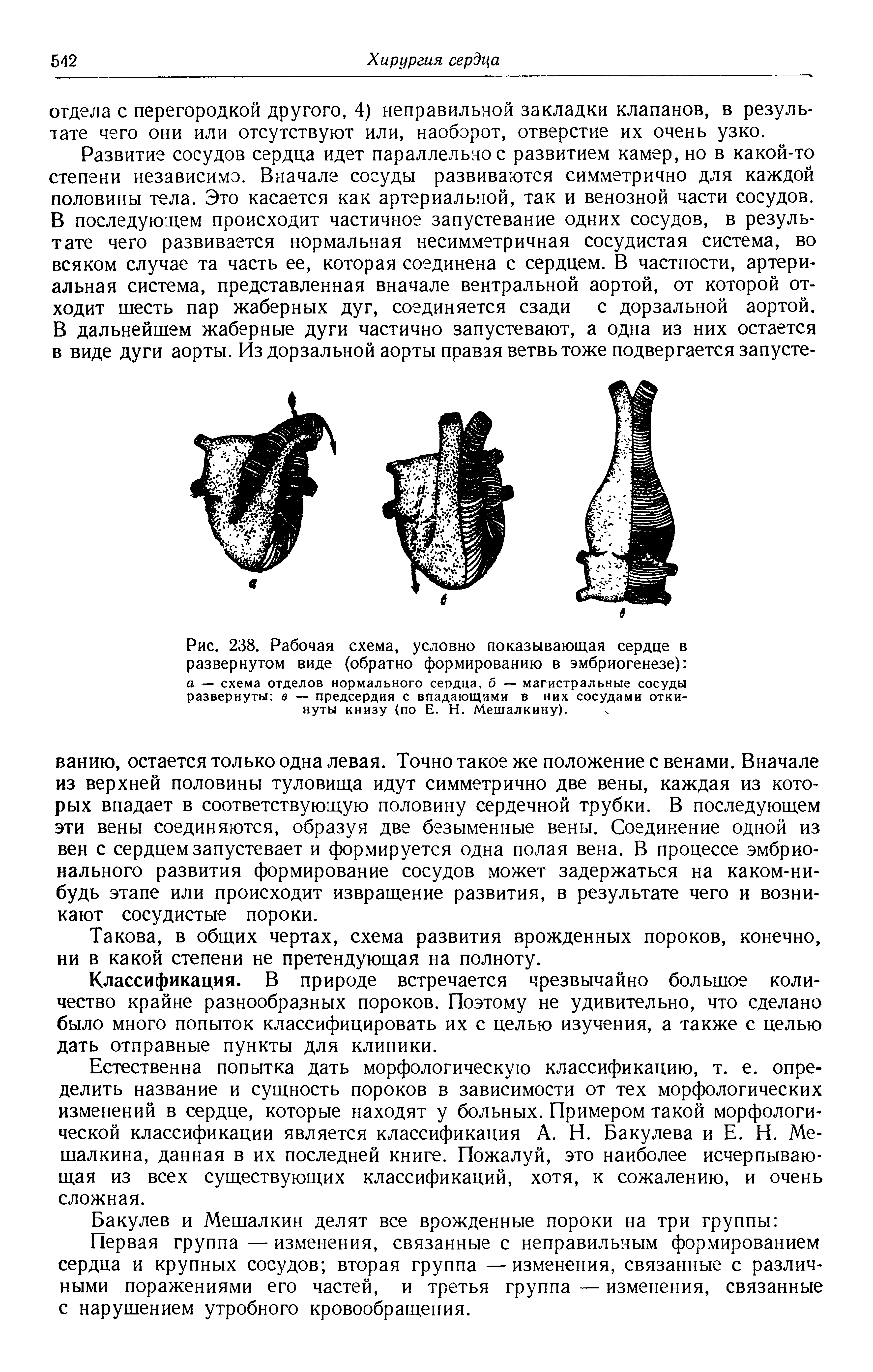 Рис. 238. Рабочая схема, условно показывающая сердце в развернутом виде (обратно формированию в эмбриогенезе) а — схема отделов нормального сердца, б — магистральные сосуды развернуты в — предсердия с впадающими в них сосудами откинуты книзу (по Е. Н. Мешалкину).