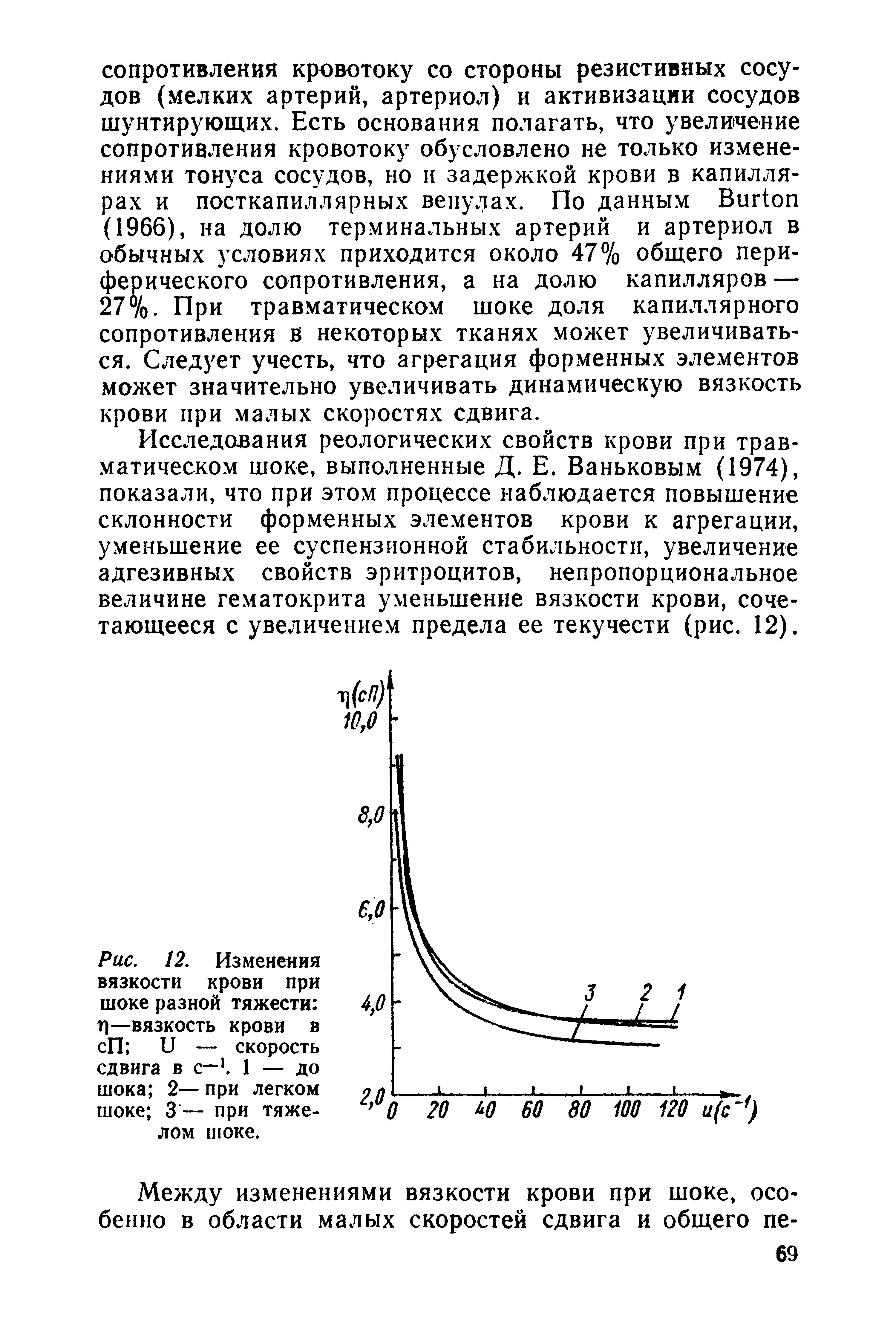 Рис. 12. Изменения вязкости крови при шоке разной тяжести Г)—вязкость крови в сП и — скорость сдвига в с—1. 1 — до шока 2—при легком шоке 3— при тяжелом шоке.