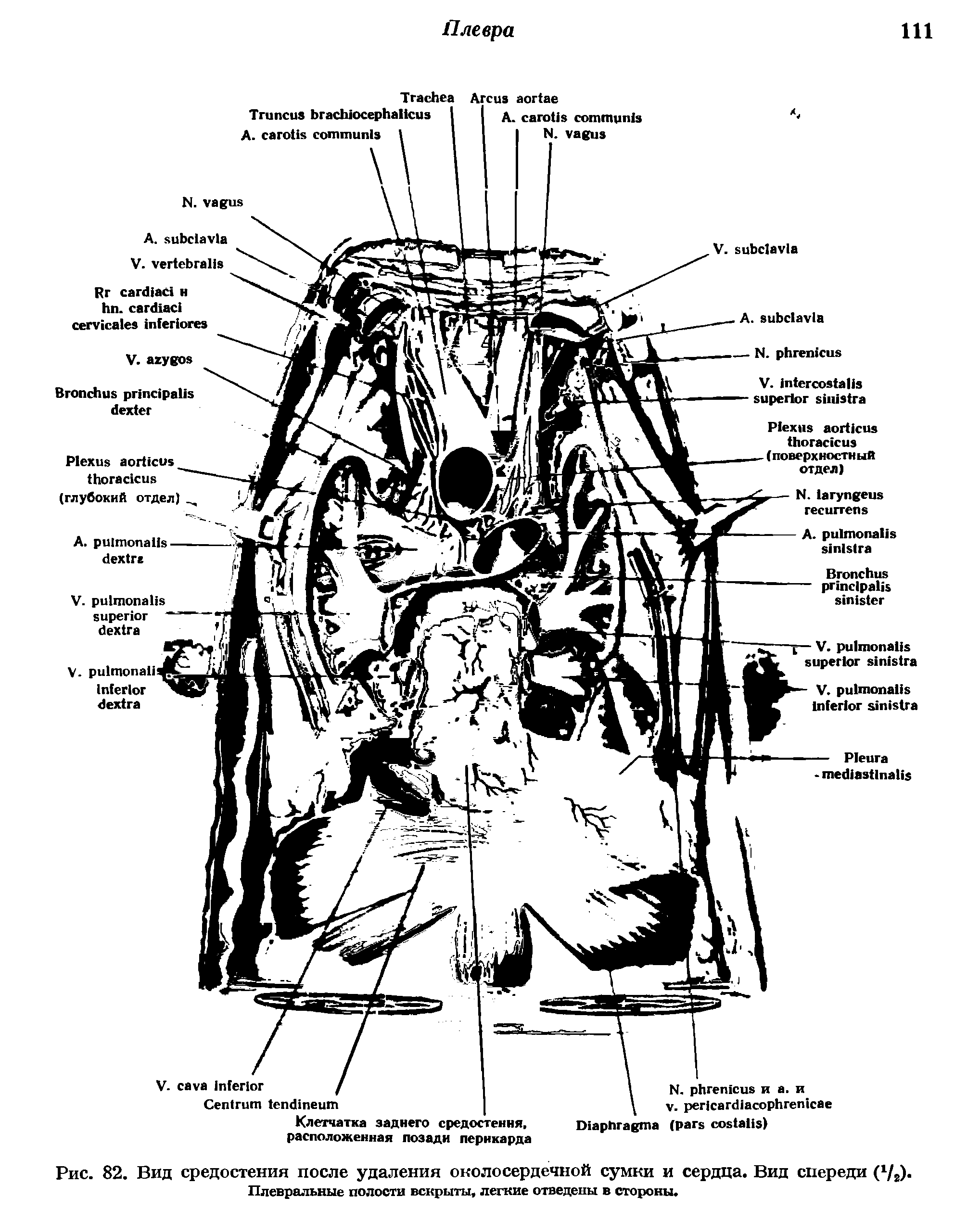 Рис. 82. Вид средостения после удаления околосердечной сумки и сердца. Вид спереди...