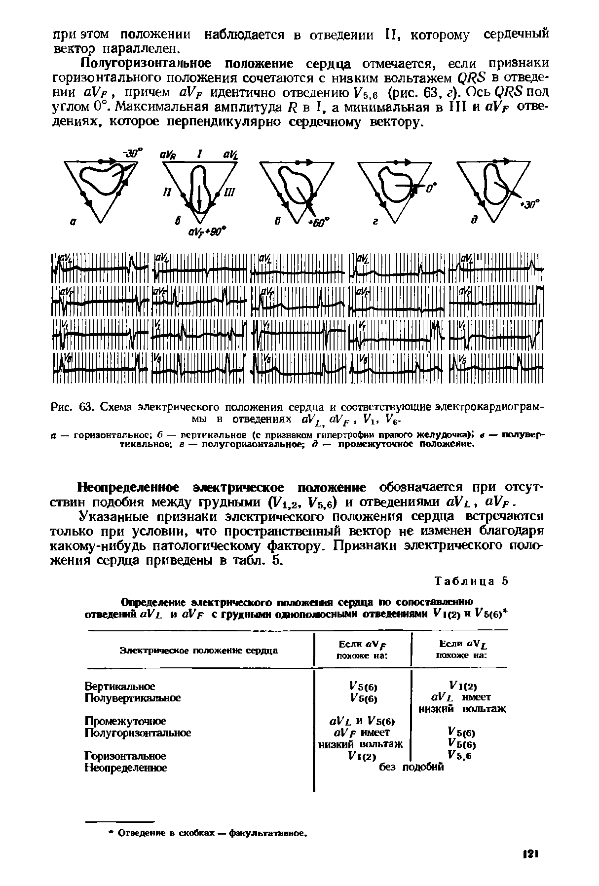 Рис. 63. Схема электрического положения сердца и соответствующие электрокардиограммы в отведениях оУ аУР, Уг, Ув.