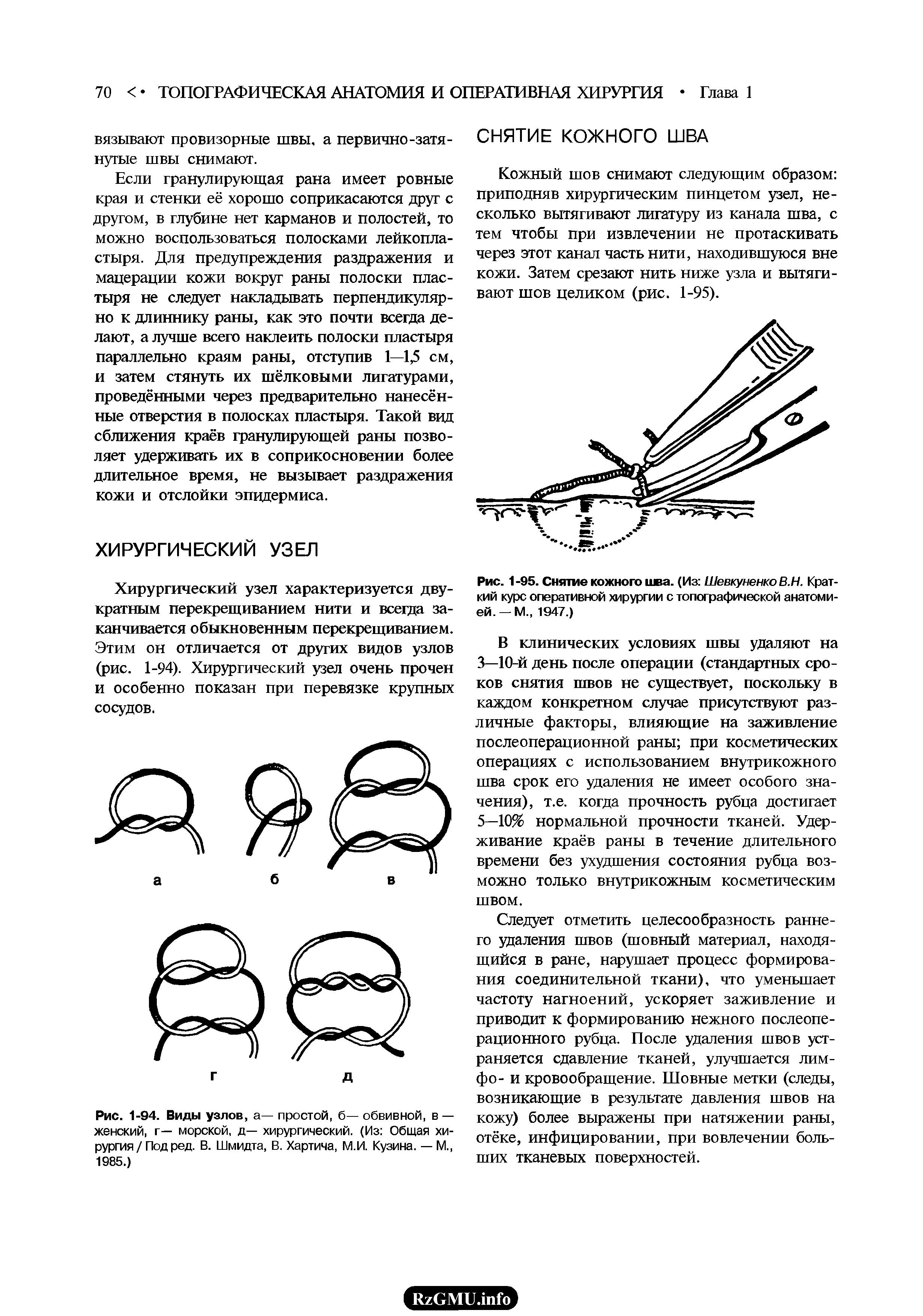 Рис. 1-95. Снятие кожного шва. (Из ШевкуненкоВ.Н. Краткий курс оперативной хирургии с топографической анатомией. — М., 1947.)...