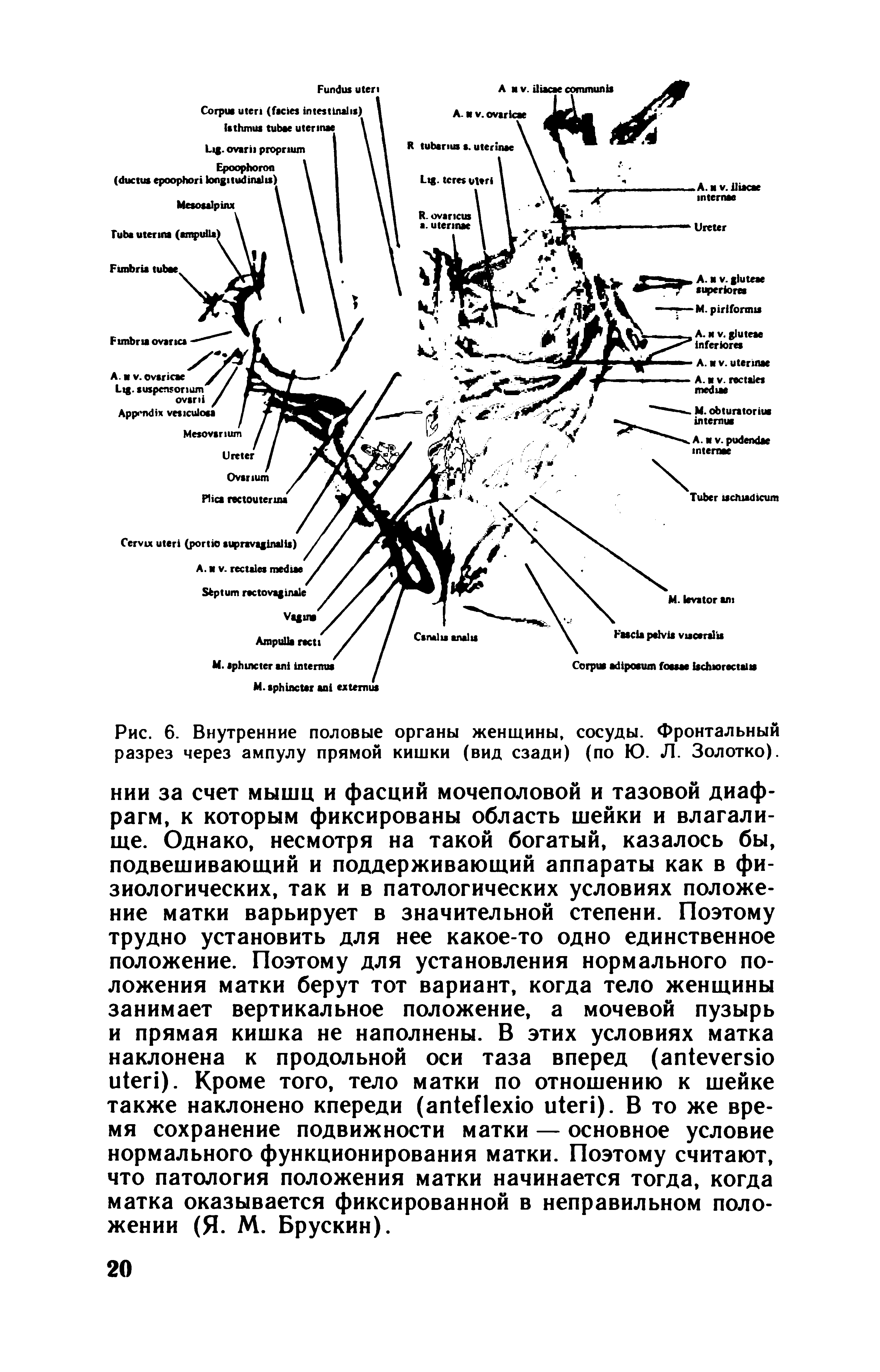 Рис. 6. Внутренние половые органы женщины, сосуды. Фронтальный разрез через ампулу прямой кишки (вид сзади) (по Ю. Л. Золотко).