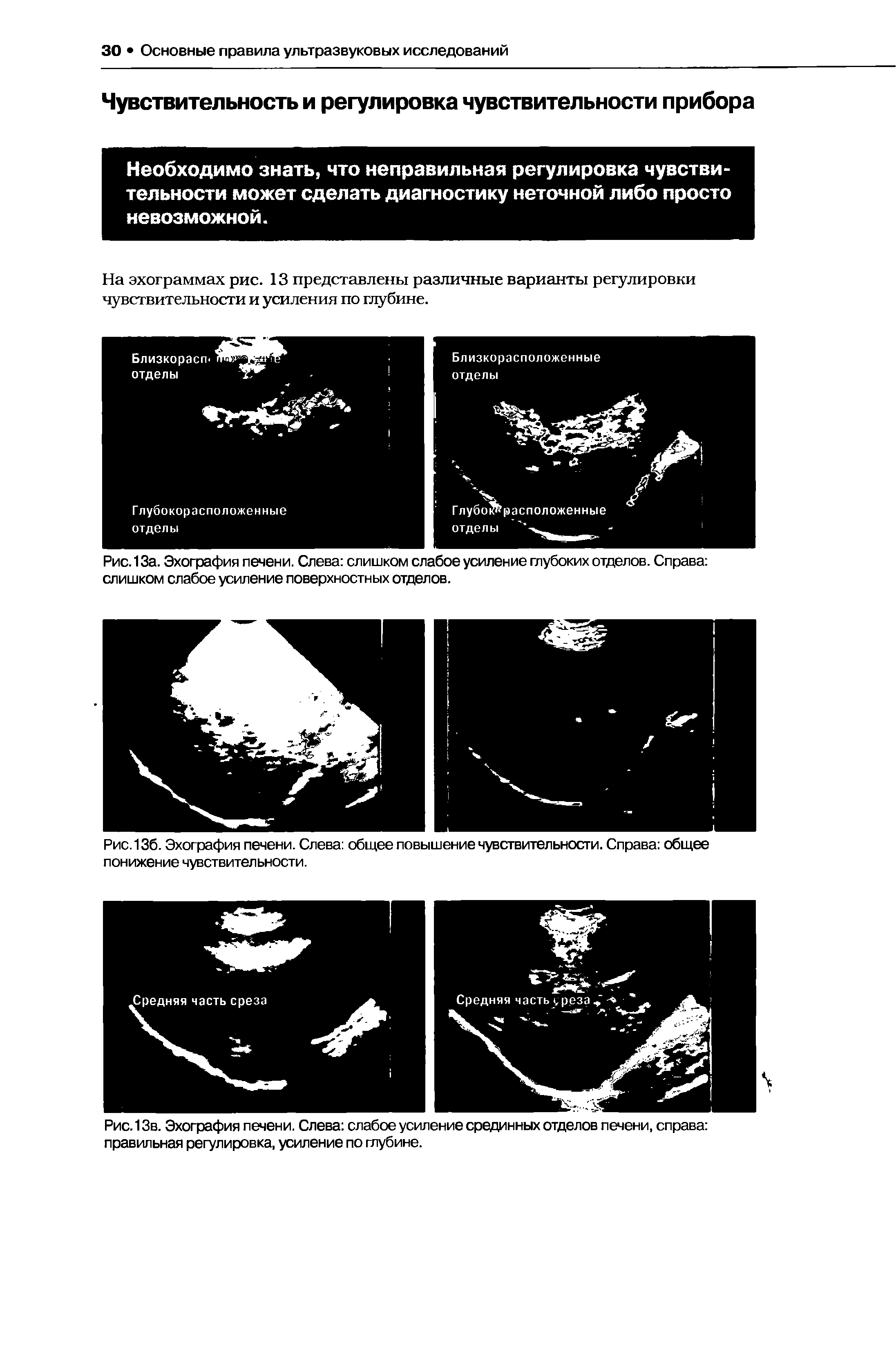 Рис. 13а. Эхография печени. Слева слишком слабое усиление глубоких отделов. Справа слишком слабое усиление поверхностных отделов.