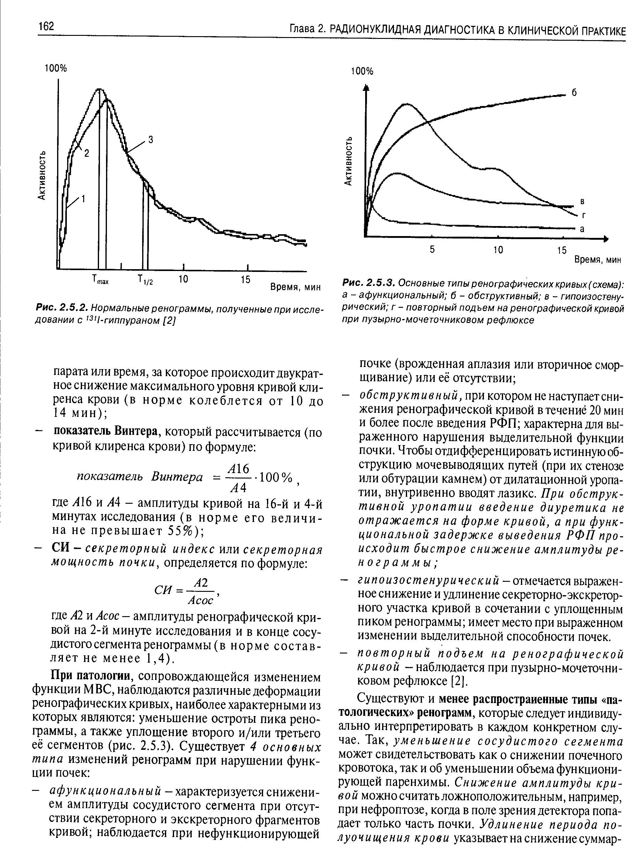 Рис. 2.5.3. Основные типы ренографических кривых (схема) а - афункциональный б - обструктивный в - гипоизостену-рический г - повторный подъем на ренографической кривой при пузырно-мочеточниковом рефлюксе...