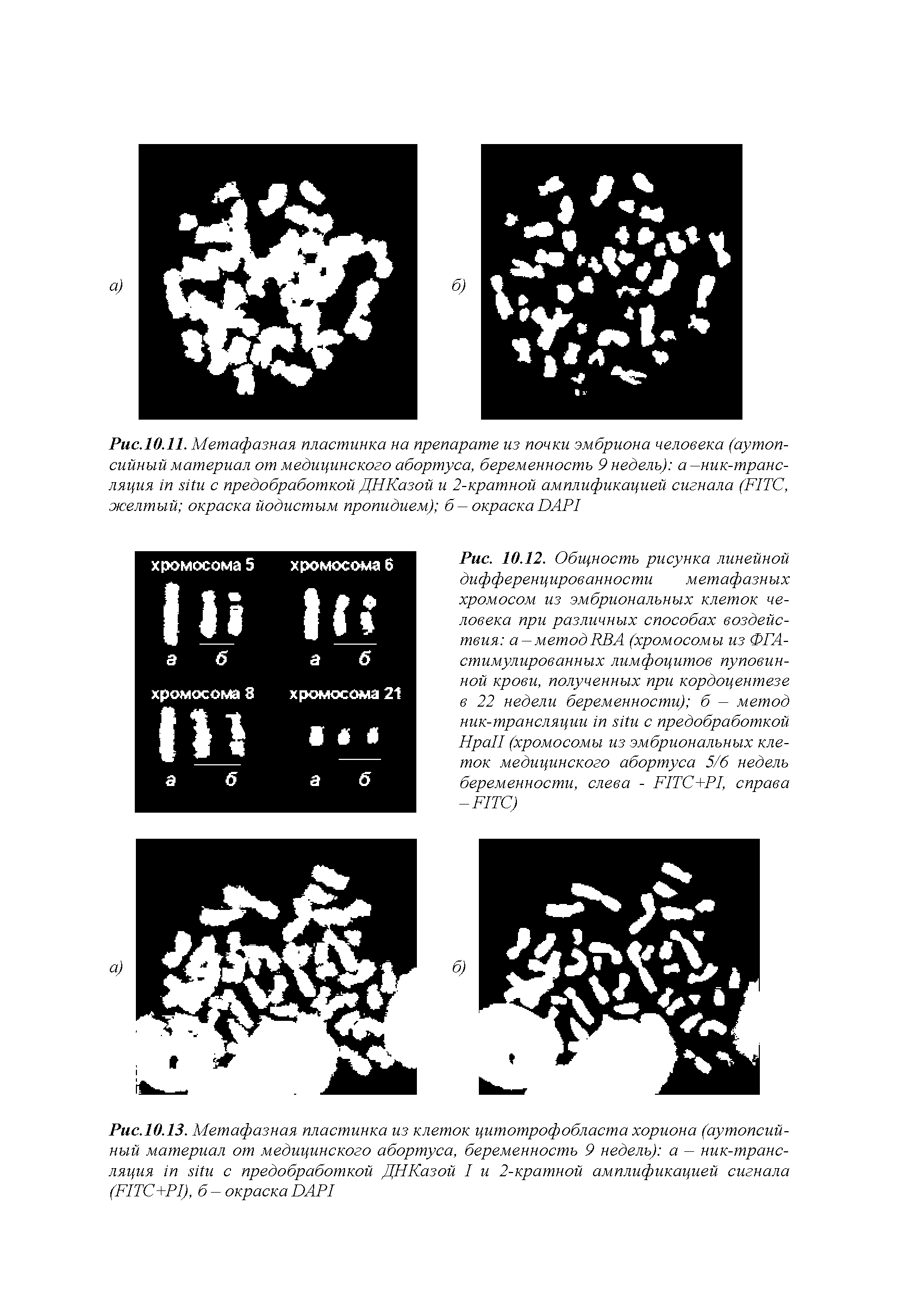 Рис.10.13. Метафазная пластинка из клеток цитотрофобласта хориона (аутопсий-ный материал от медицинского абортуса, беременность 9 недель) а — ник-транс-ляция с предобработкой ДНКазой I и 2-кратной амплификацией сигнала (FITC+PI), б-окраскаDAPI...