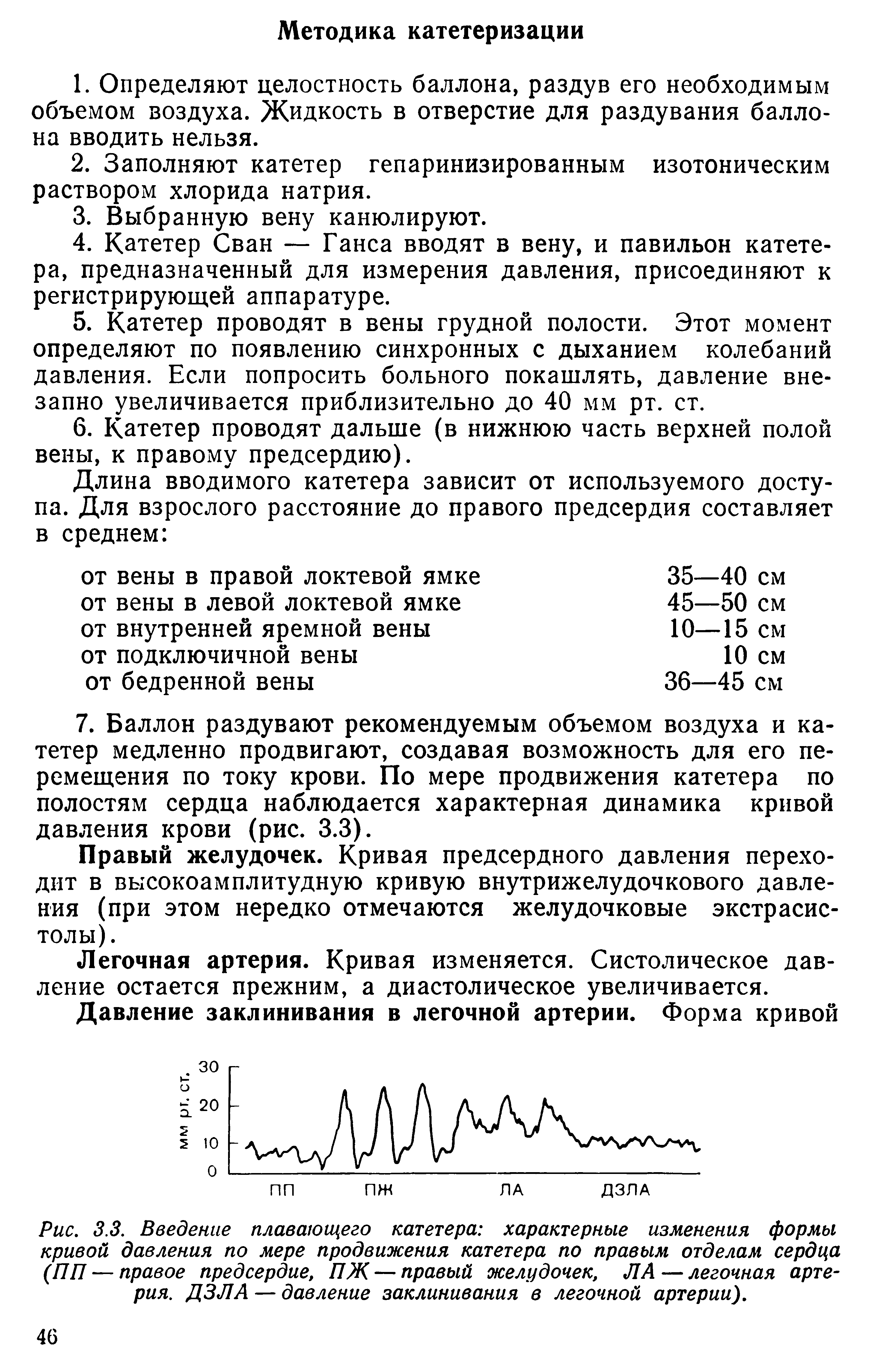 Рис. 3.3. Введение плавающего катетера характерные изменения формы кривой давления по мере продвижения катетера по правым отделам сердца (ПП — правое предсердие, ПЖ— правый желудочек, ЛА—легочная артерия. ДЗЛА — давление заклинивания в легочной артерии).