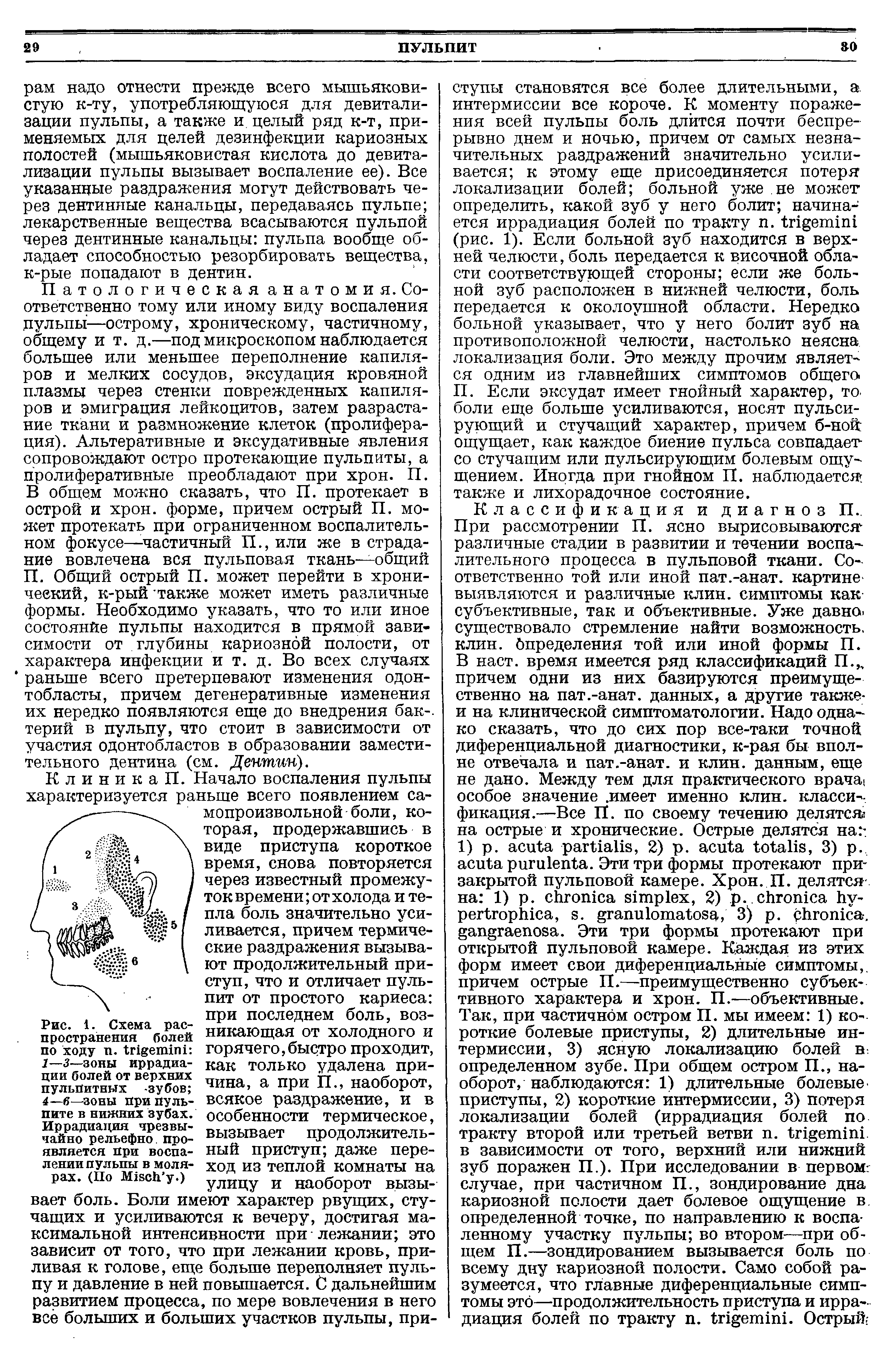 Рис. 1. Схема распространения болей по ходу п. 1—3—зоны иррадиации болей от верхних пульПитных -зубов 4— 6—зоны при пульпите в нижних зубах. Иррадиация чрезвычайно рельефно проявляется при воспалении пульпы в молярах. (По M .)...