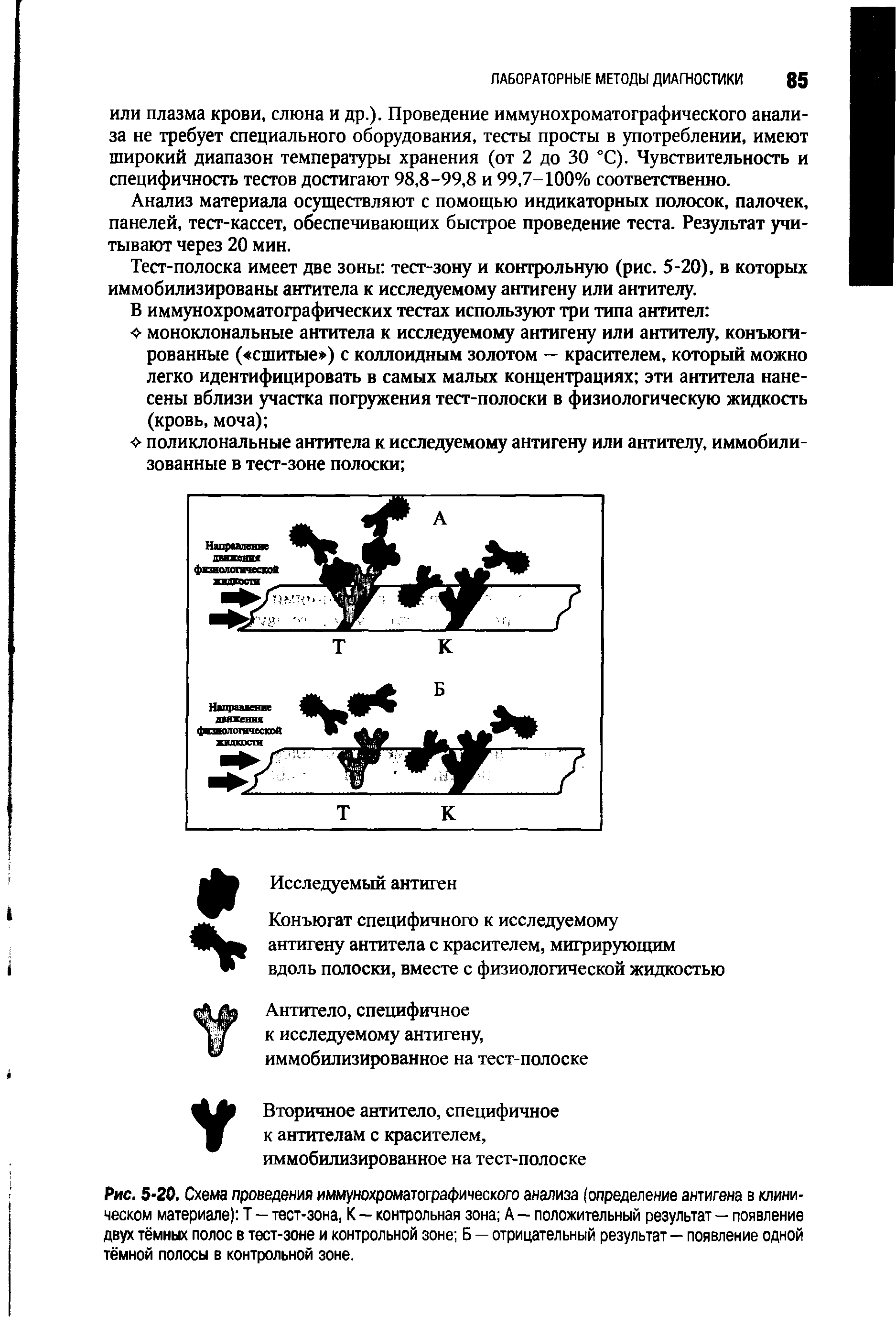 Рис. 5-20. Схема проведения иммунохроматографического анализа (определение антигена в клиническом материале) Т — тест-зона, К — контрольная зона А — положительный результат — появление двух тёмных полос в тест-зоне и контрольной зоне Б — отрицательный результат — появление одной тёмной полосы в контрольной зоне.