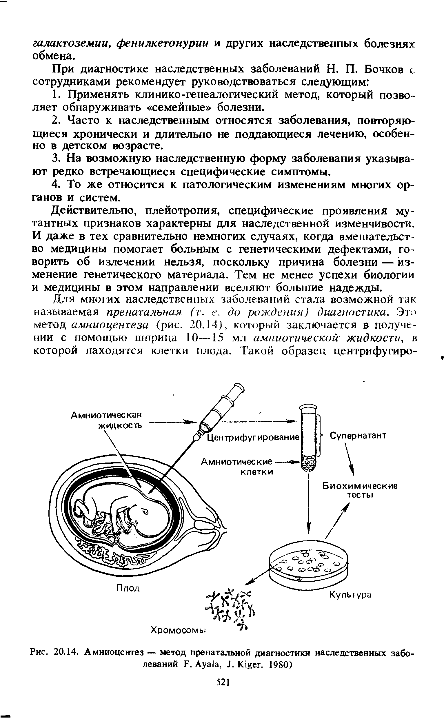 Рис. 20.14. Амниоцентез — метод пренатальной диагностики наследственных заболеваний F. A , J. K . 1980)...