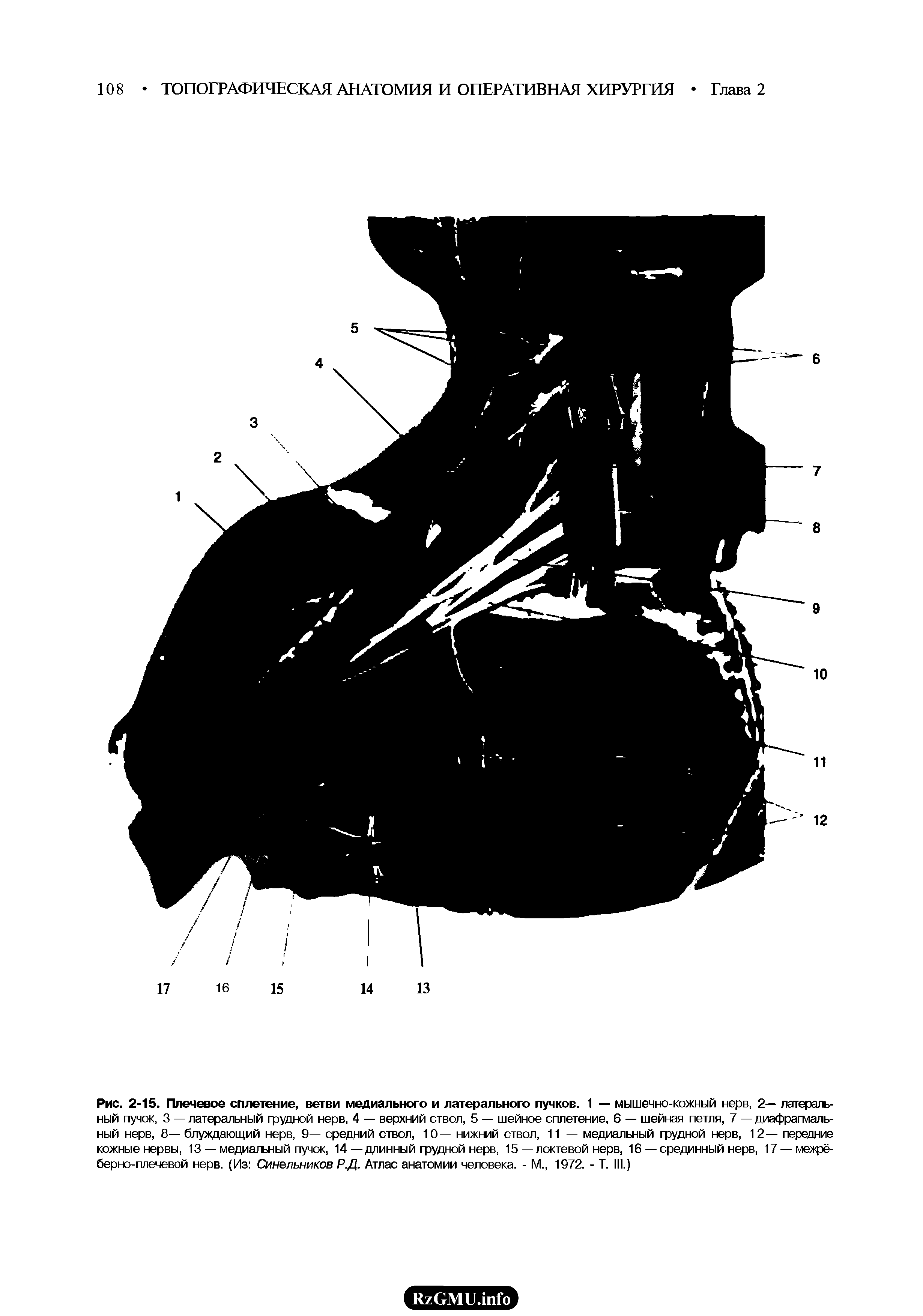 Рис. 2-15. Плечевое сплетение, ветви медиального и латерального пучков. 1 — мышечно-кожный нерв, 2— латеральный пучок, 3 — латеральный грудной нерв, 4 — верхний ствол, 5 — шейное сплетение, 6 — шейная петля, 7 — диафрагмальный нерв, 8— блуждающий нерв, 9— средний ствол, 10— нижний ствол, 11 — медиальный грудной нерв, 12— передние кожные нервы, 13 — медиальный пучок, 14—длинный грудной нерв, 15—локтевой нерв, 16— срединный нерв, 17 — межрё-берно-плечевой нерв. (Из Синельников Р.Д. Атлас анатомии человека. - М., 1972. - Т. III.)...