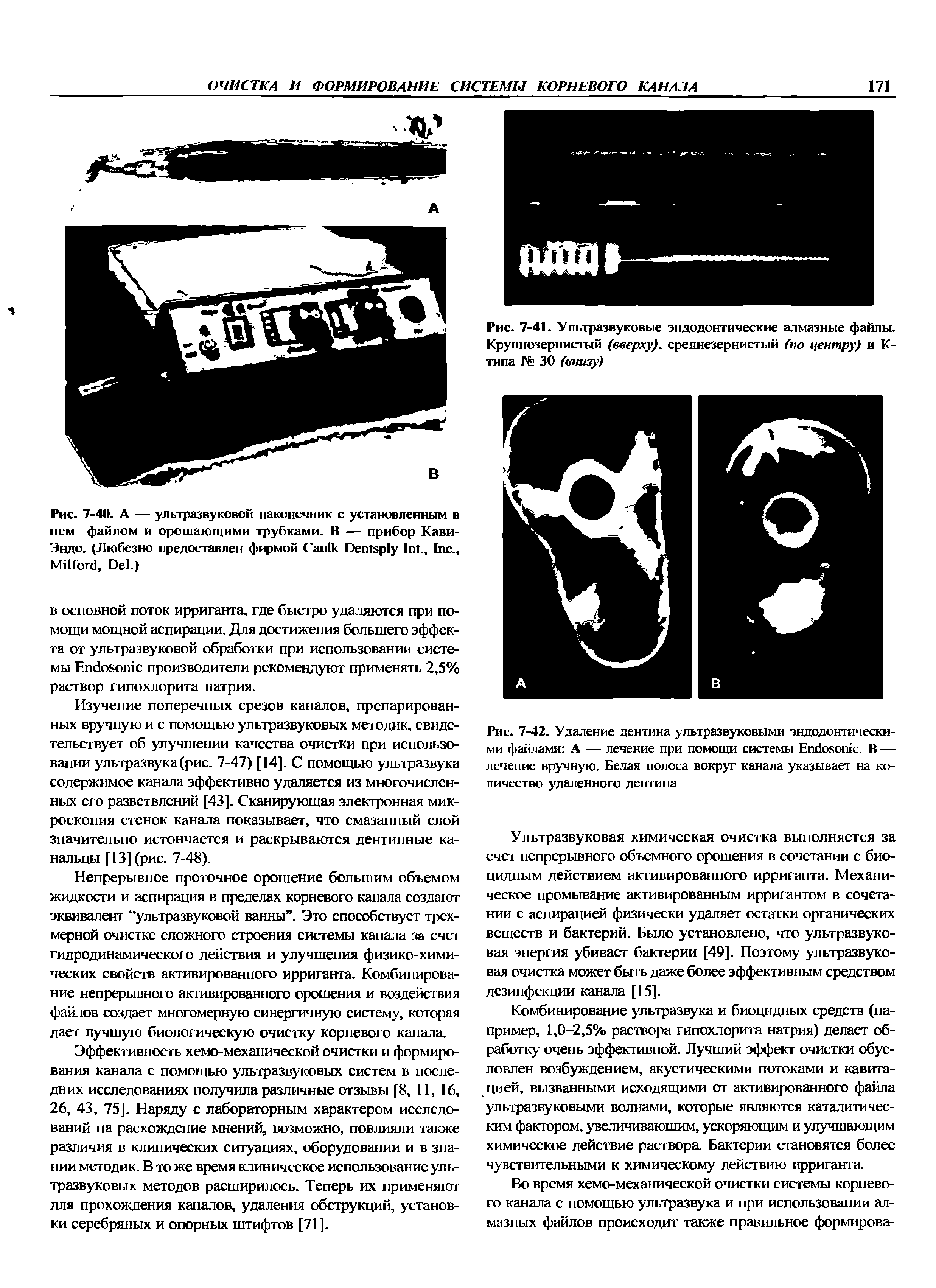 Рис. 7-42. Удаление дентина ультразвуковыми эндодонтическими файлами А — лечение при помощи системы Епёовошс. В — лечение вручную. Белая полоса вокруг канала указывает на количество удаленного дентина...