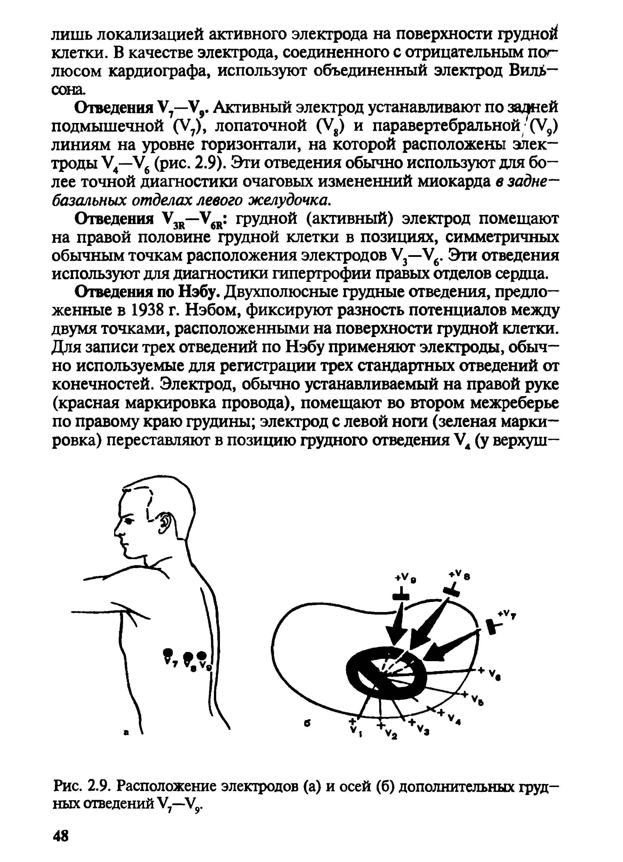 Рис. 2.9. Расположение электродов (а) и осей (б) дополнительных грудных отведений У7—У9.