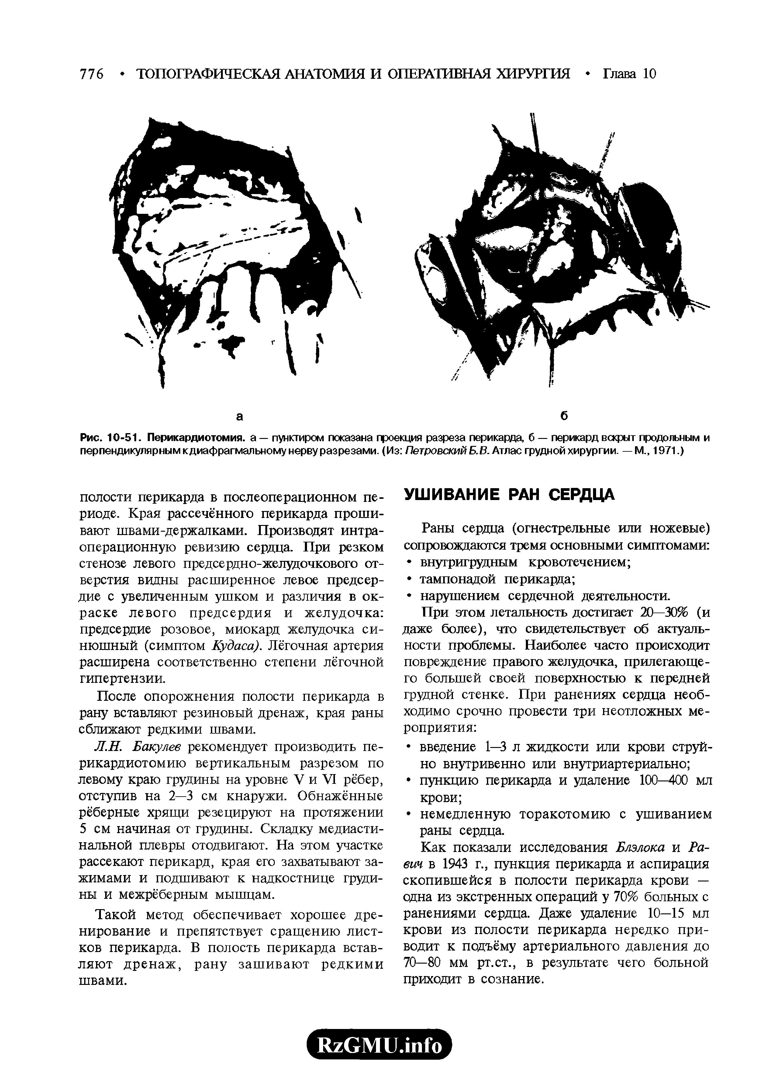 Рис. 10-51. Перикардиотомия. а — пунктиром показана проекция разреза перикарда, б — перикард вскрыт продольным и перпендикулярным кдиафрагмальному нерву разрезами. (Из Петровский Б.В. Атлас грудной хирургии. — М., 1971.)...