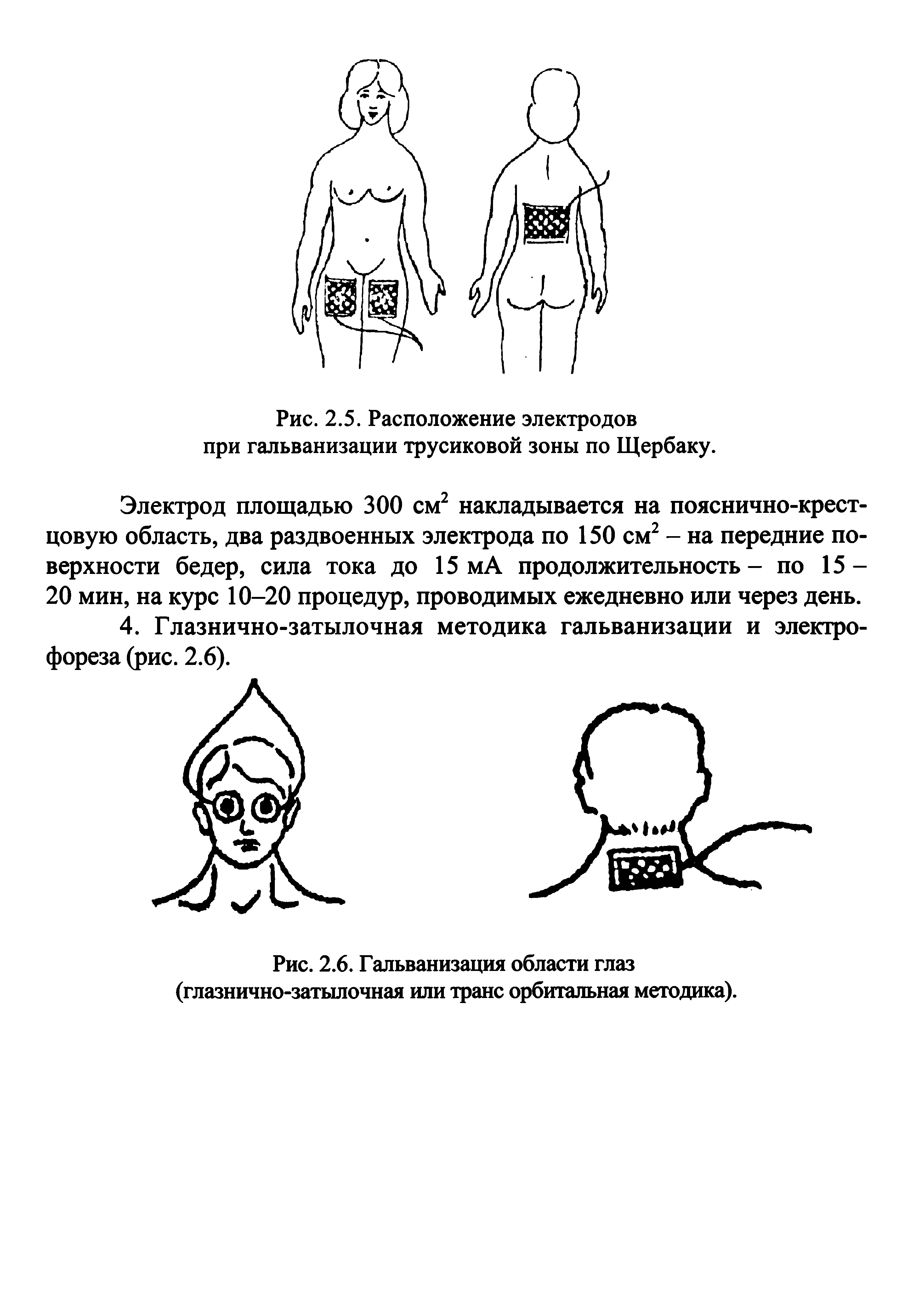 Рис. 2.6. Гальванизация области глаз (глазнично-затылочная или транс орбитальная методика).