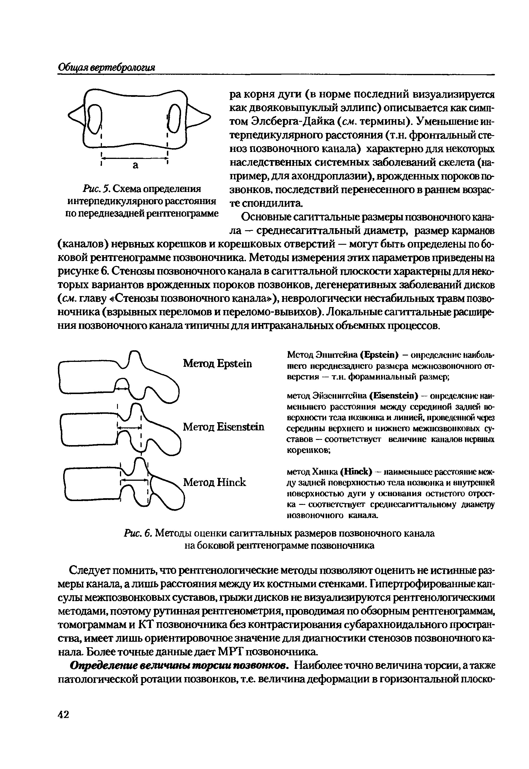 Рис. 6. Методы оценки сагиттальных размеров позвоночного канала на боковой рентгенограмме позвоночника...