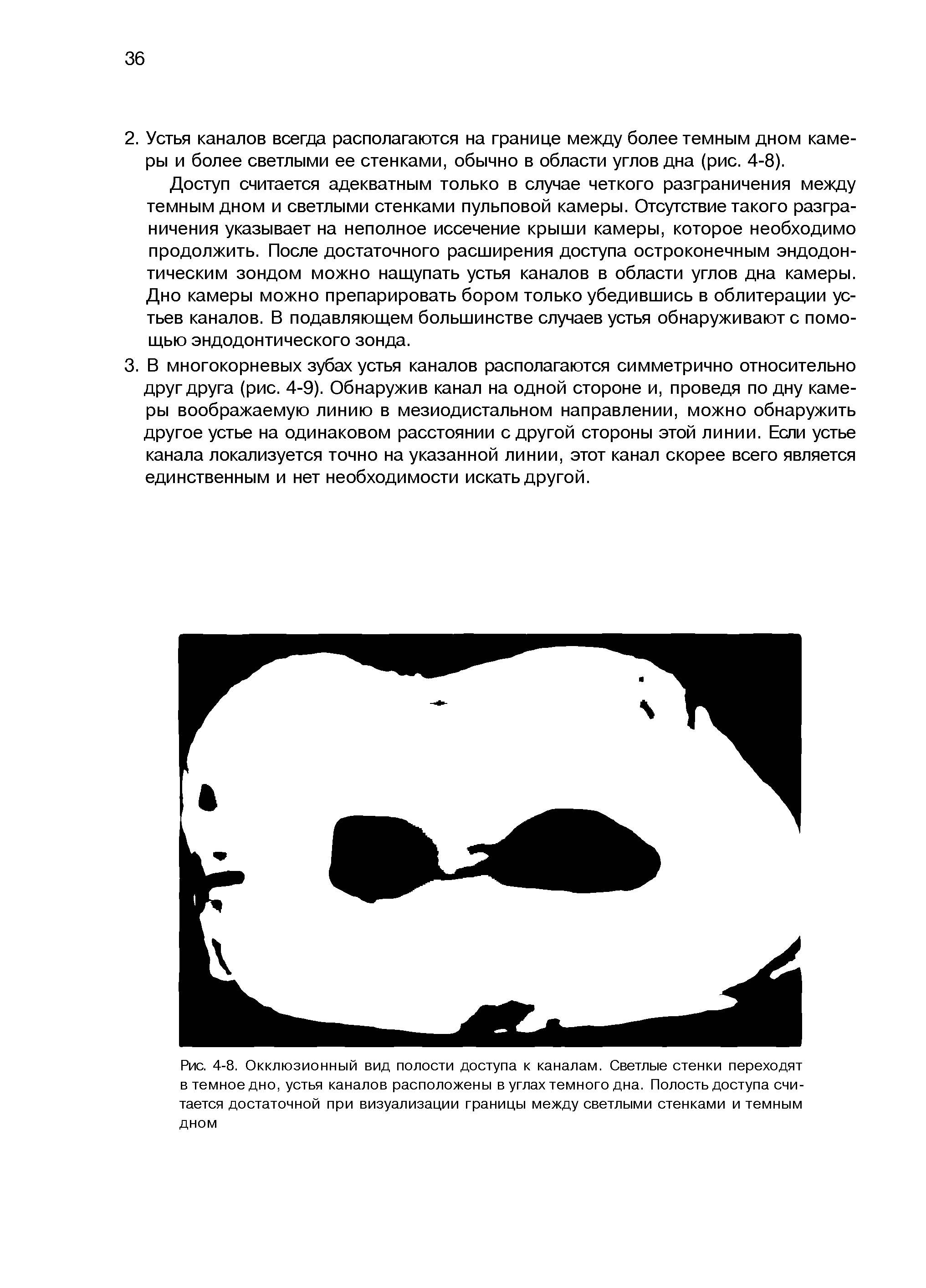 Рис. 4-8. Окклюзионный вид полости доступа к каналам. Светлые стенки переходят в темное дно, устья каналов расположены в углах темного дна. Полость доступа считается достаточной при визуализации границы между светлыми стенками и темным дном...