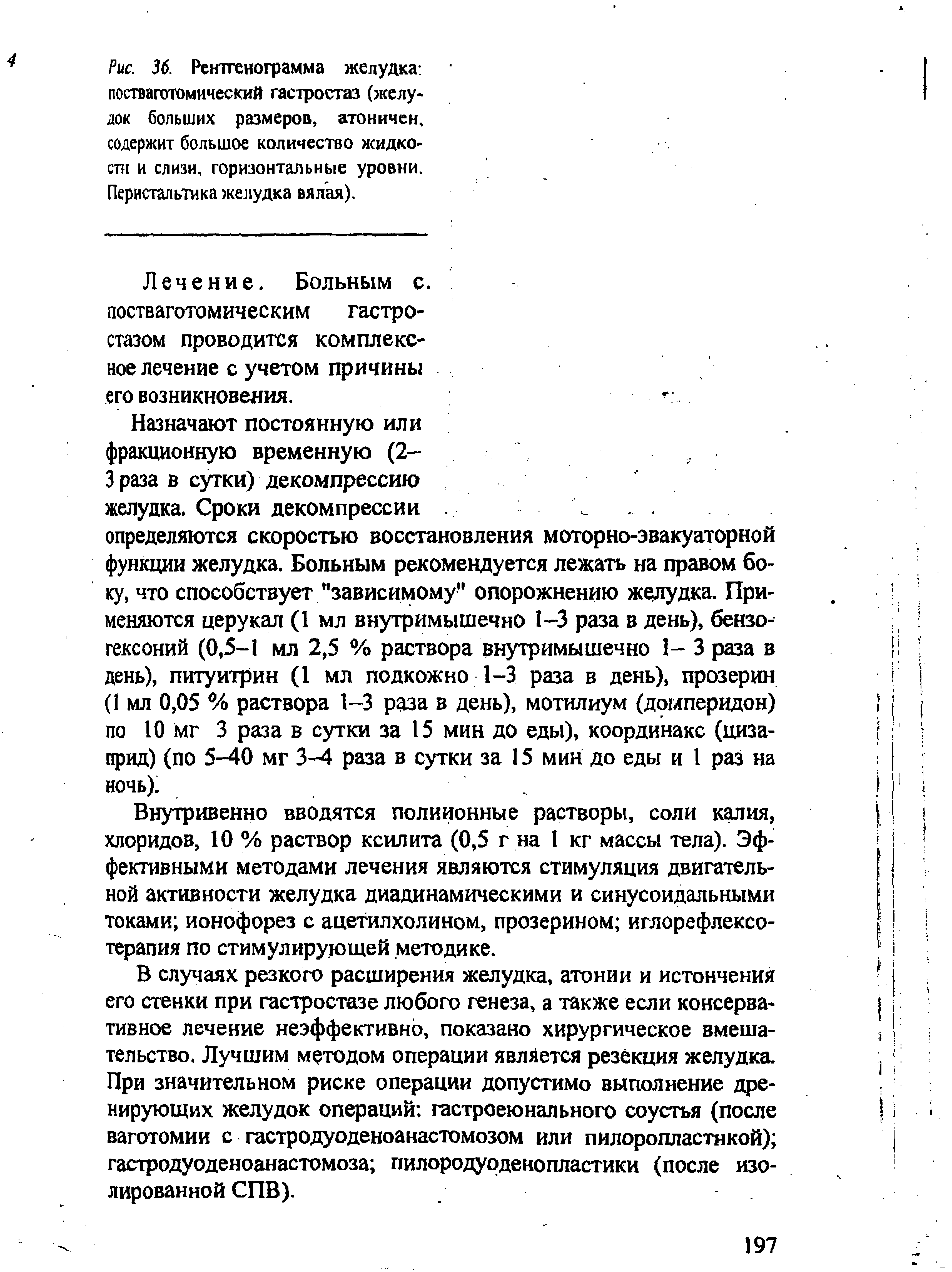 Рис. 36. Рентгенограмма желудка постваготомический гастростаз (желудок больших размеров, атоничен, содержит большое количество жидкости и слизи, горизонтальные уровни. Перистальтика желудка вялая).