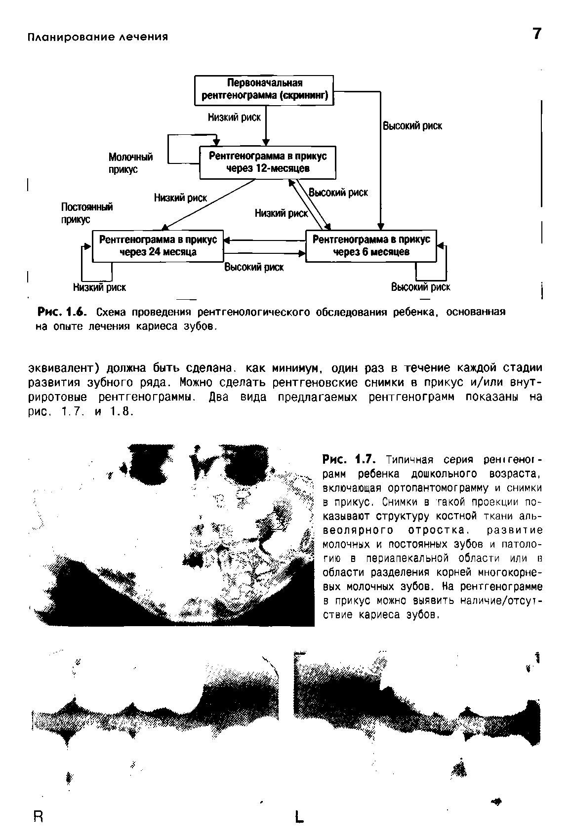 Рис.1.6. Схема проведения рентгенологического обследования ребенка, основанная на опыте лечения кариеса зубов.