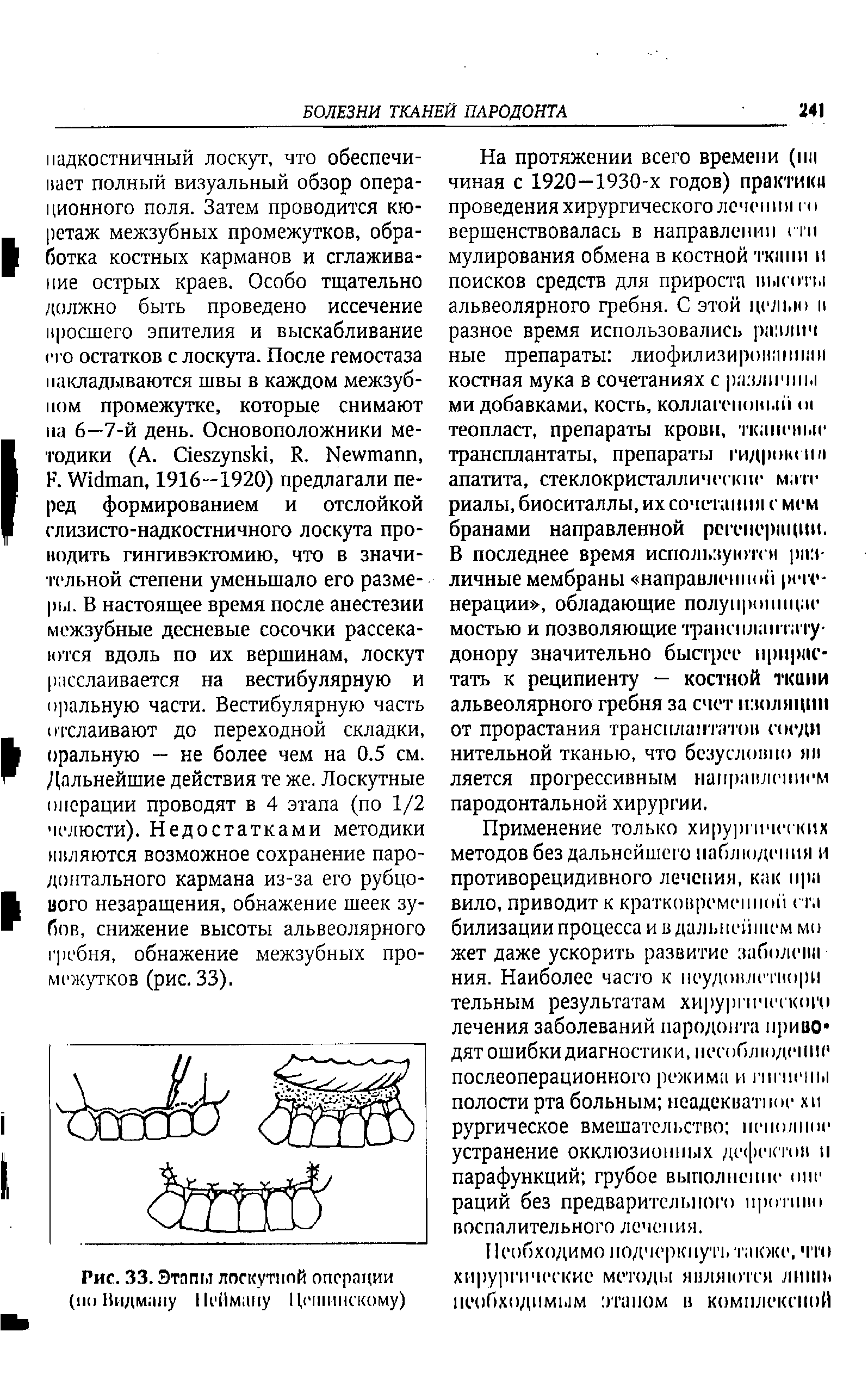 Рис. 33. Этапы лоскутной операции (по Видману Нейману Цепншскому)...