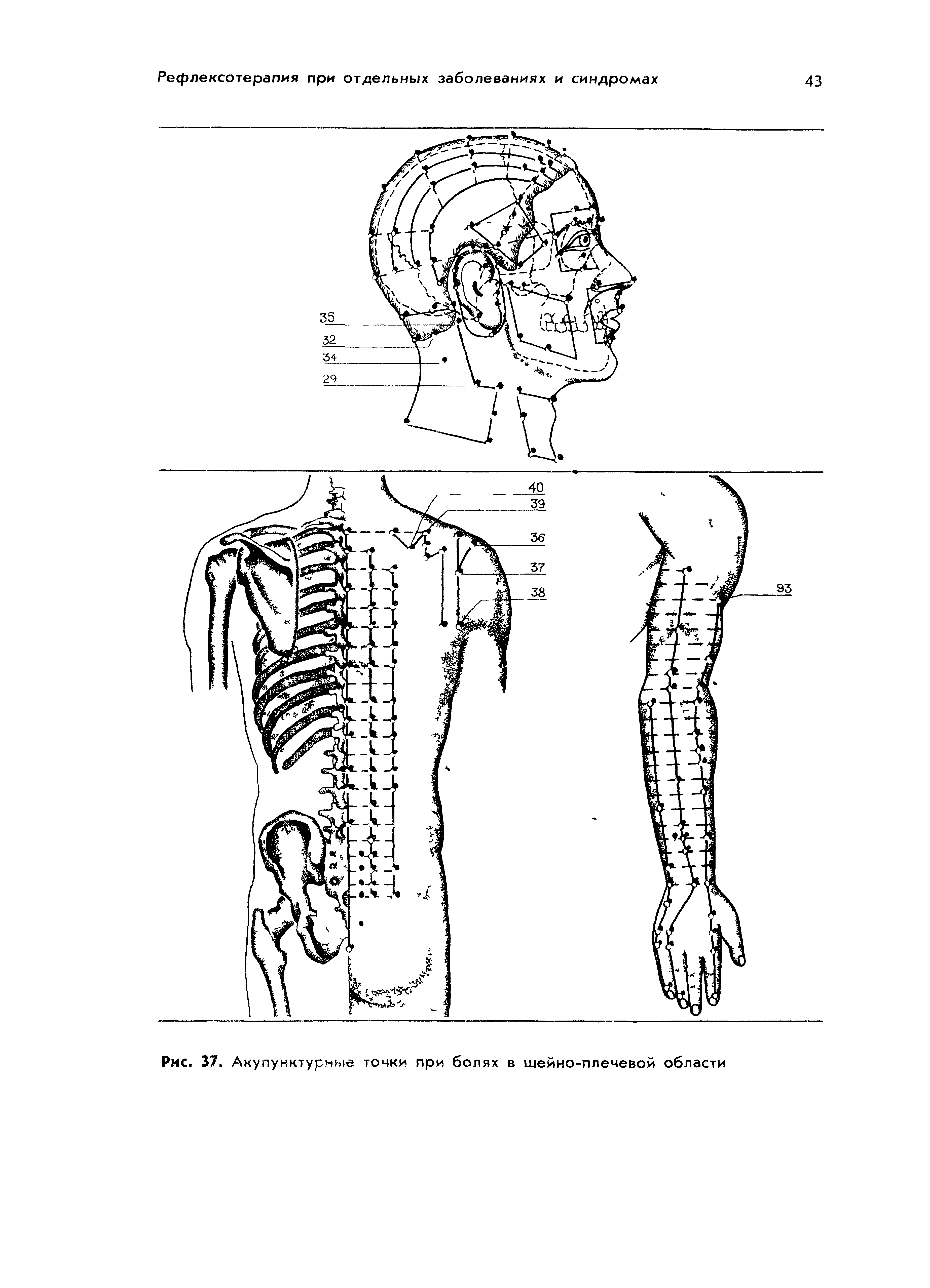 Рис. 37. Акупунктурные точки при болях в шейно-плечевой области...