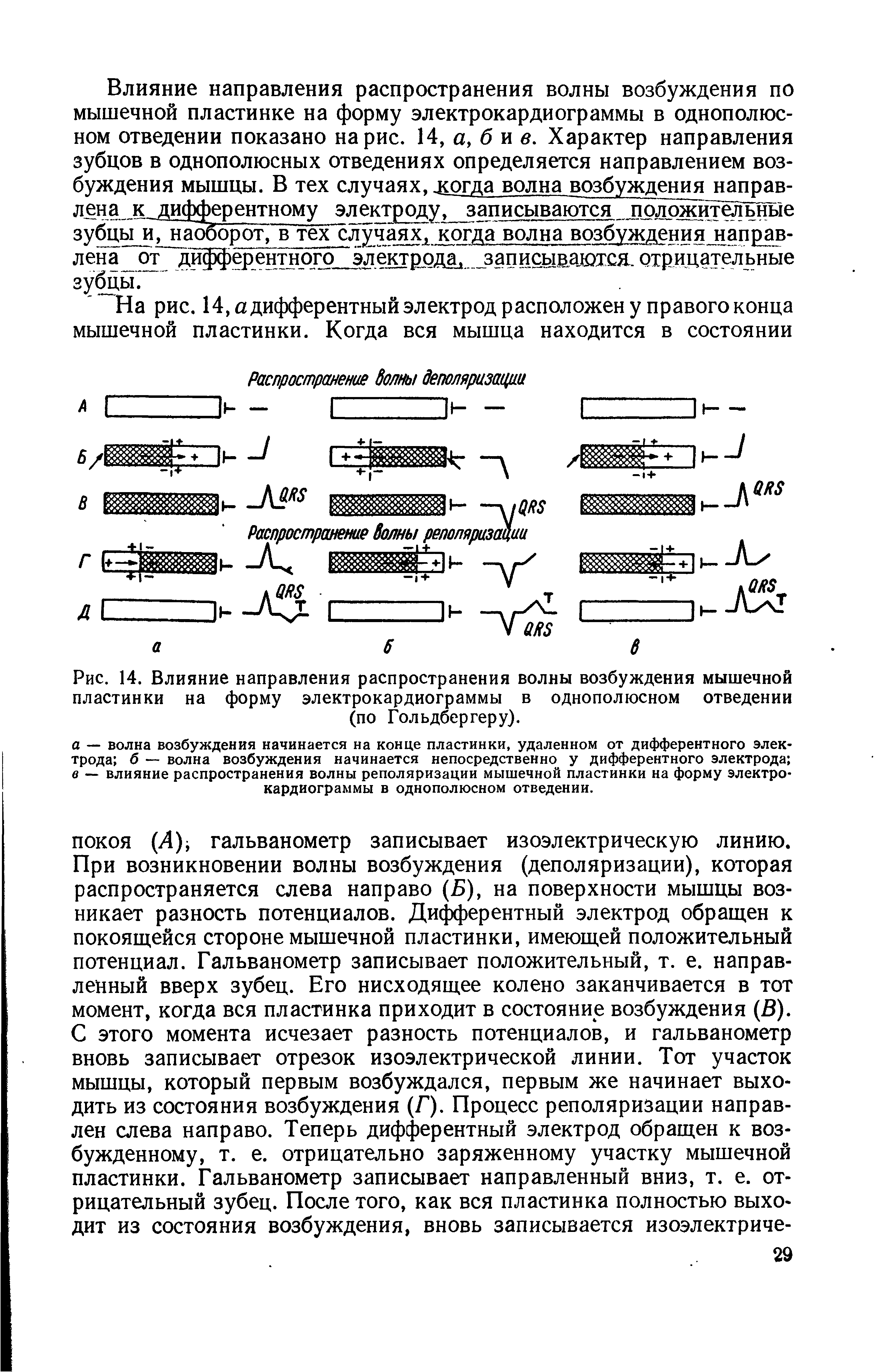 Рис. 14. Влияние направления распространения волны возбуждения мышечной пластинки на форму электрокардиограммы в однополюсном отведении (по Гольдбергеру).