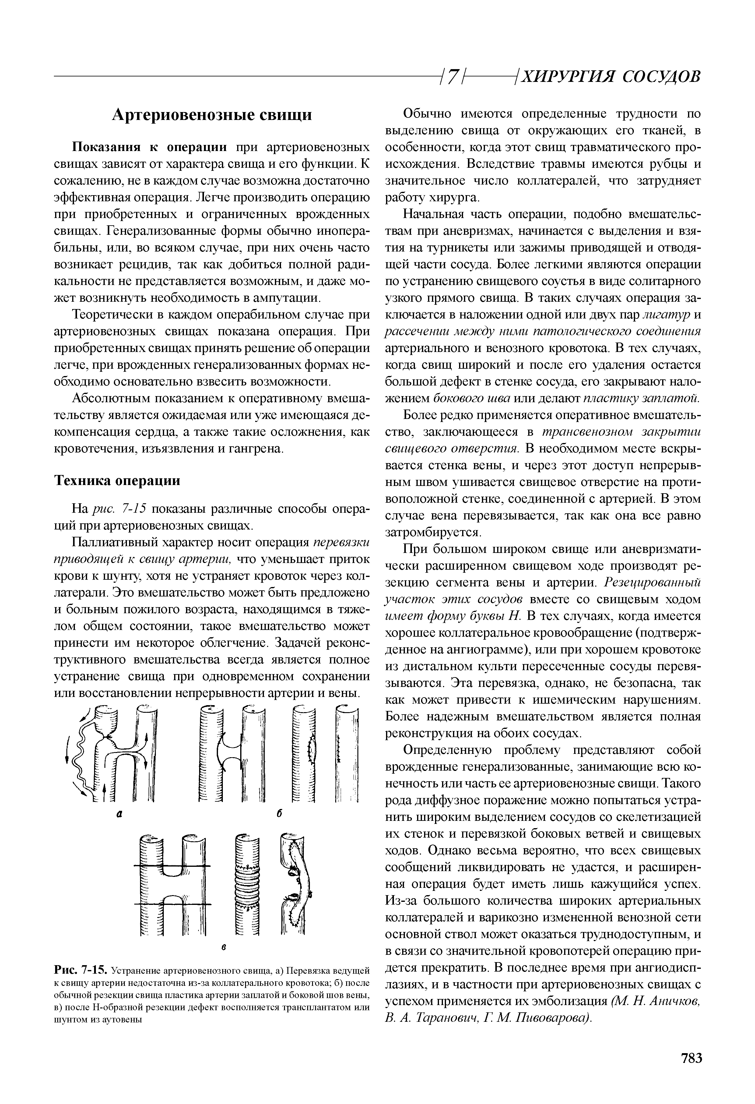 Рис. 7-15. Устранение артериовенозного свища, а) Перевязка ведущей к свищу артерии недостаточна из-за коллатерального кровотока б) после обычной резекции свища пластика артерии заплатой и боковой шов вены, в) после Н-образной резекции дефект восполняется трансплантатом или шунтом из аутовены...