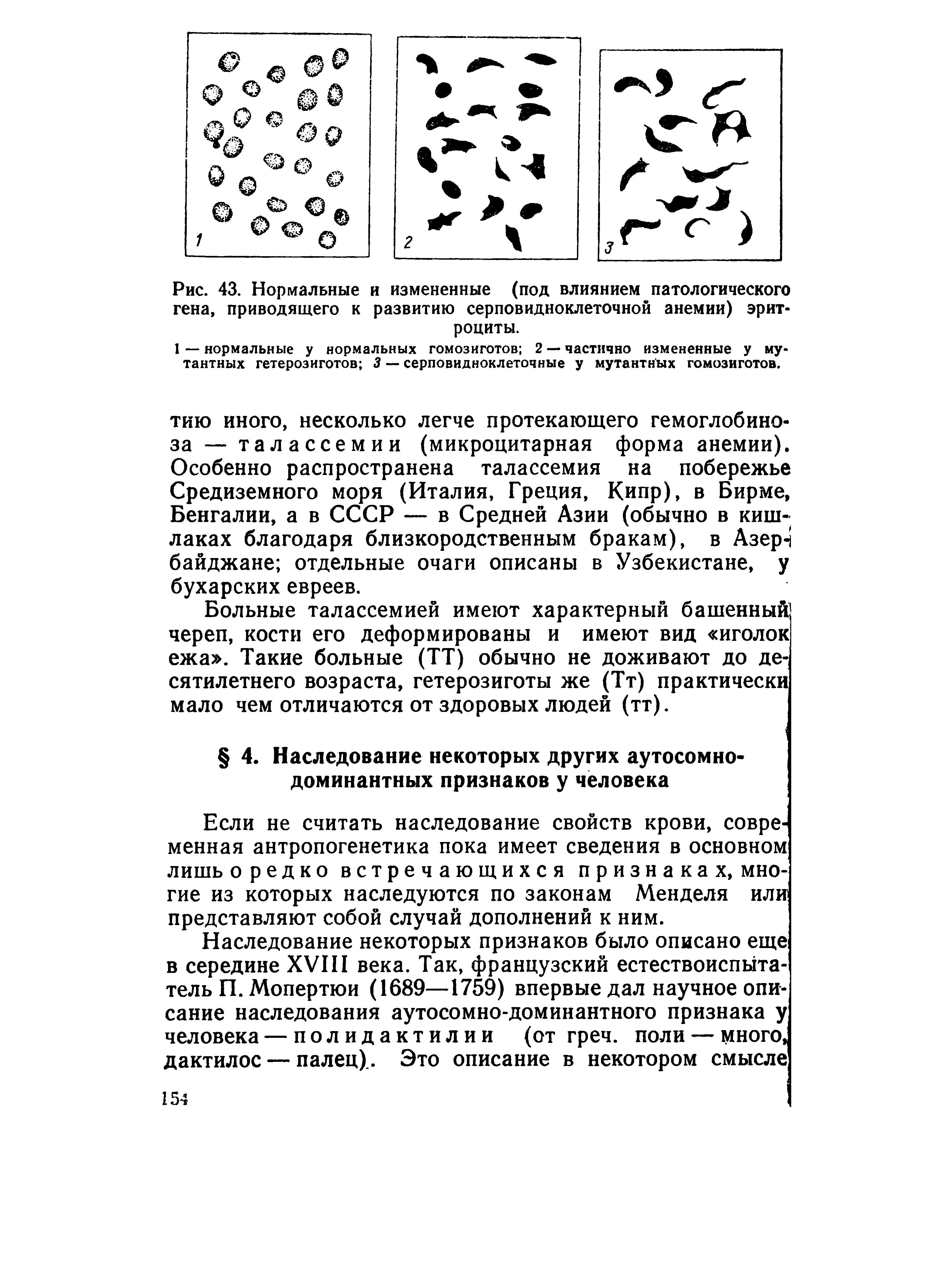 Рис. 43. Нормальные и измененные (под влиянием патологического гена, приводящего к развитию серповидноклеточной анемии) эритроциты.