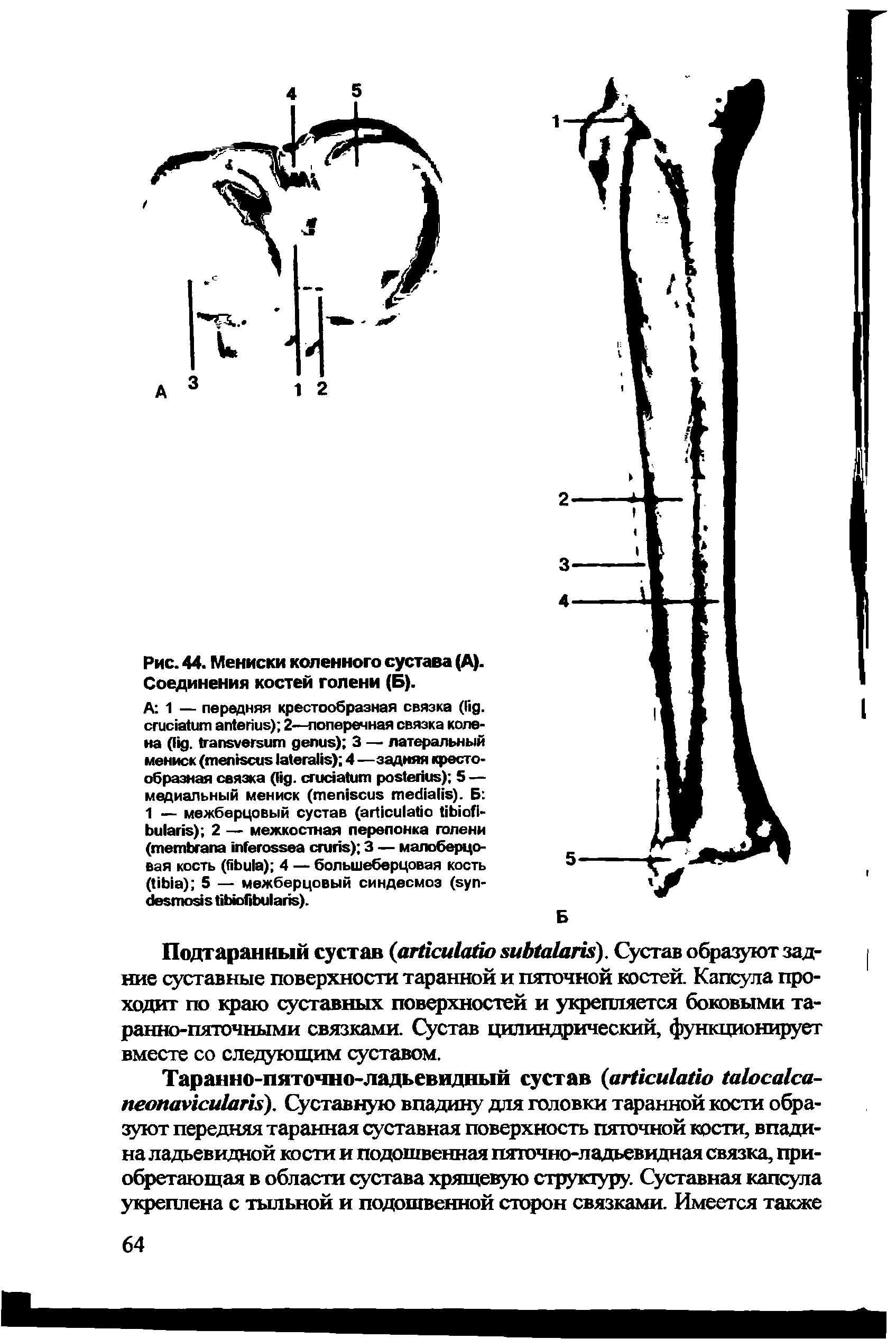 Рис. 44. Мениски коленного сустава (А). Соединения костей голени (Б).
