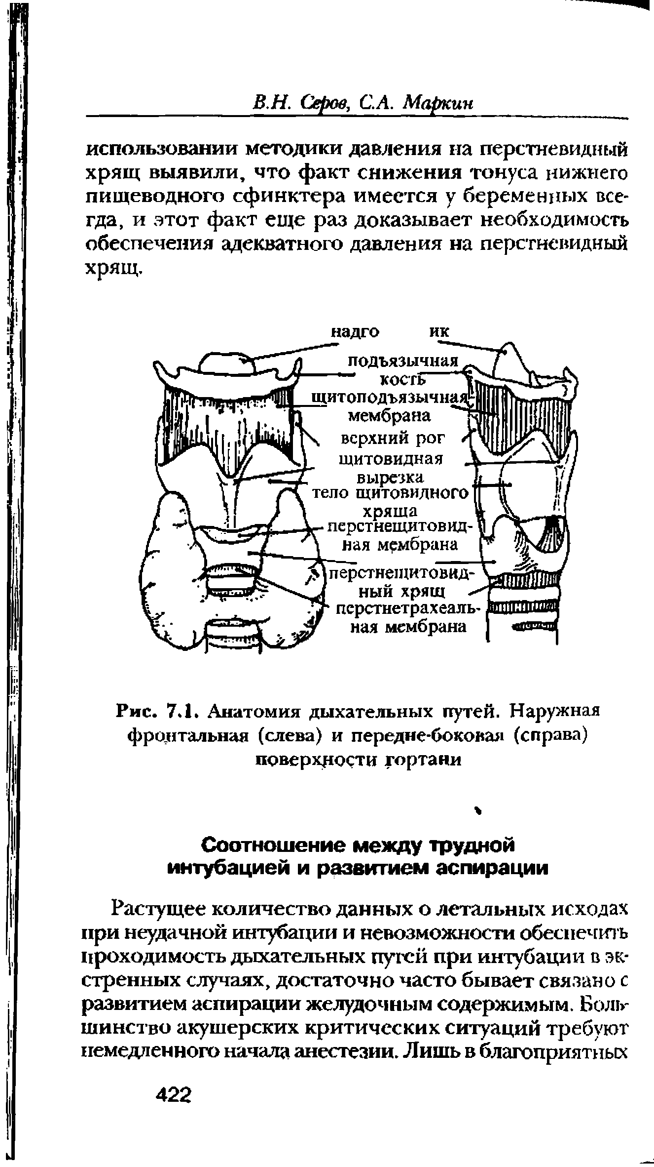 Рис. 7.1. Анатомия дыхательных путей. Наружная фронтальная (слева) и передне-боковая (справа) поверхности гортани...