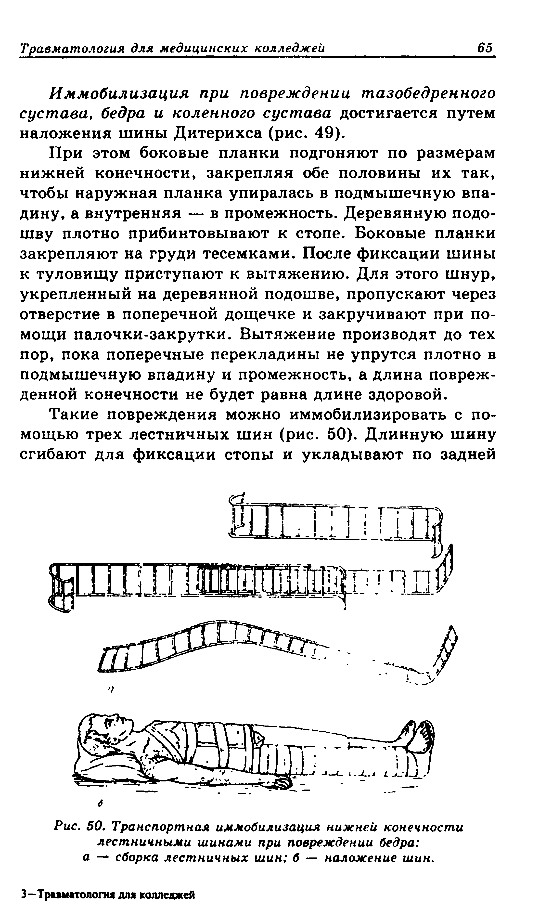 Рис. 50. Транспортная иммобилизация нижней конечности лестничными шинами при повреждении бедра а — сборка лестничных шин б — наложение шин.