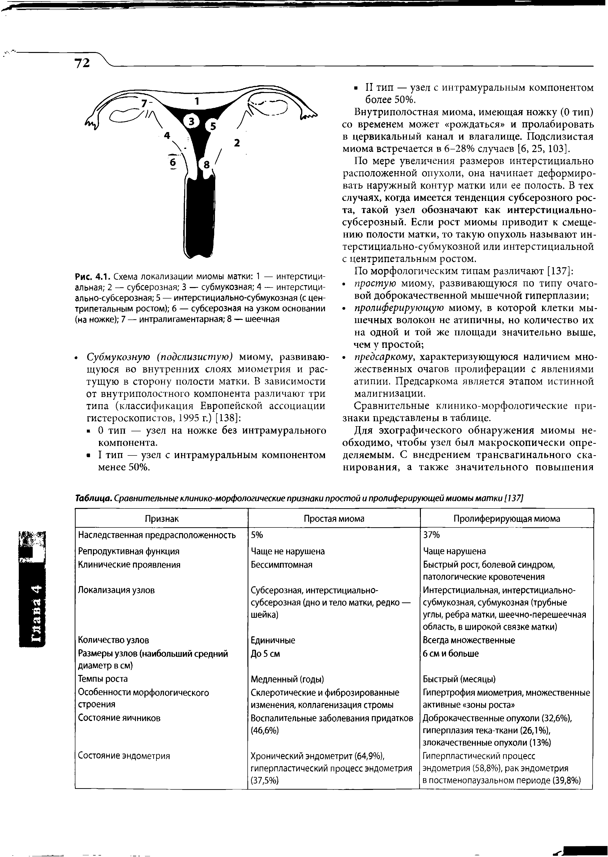 Рис. 4.1. Схема локализации миомы матки 1 — интерстициальная 2 — субсерозная 3 — субмукозная 4 — интерстици-ально-субсерозная 5 — интерстициально-субмукозная (с цен-трипетальным ростом) б — субсерозная на узком основании (на ножке) 7 — интралигаментарная 8 — шеечная...