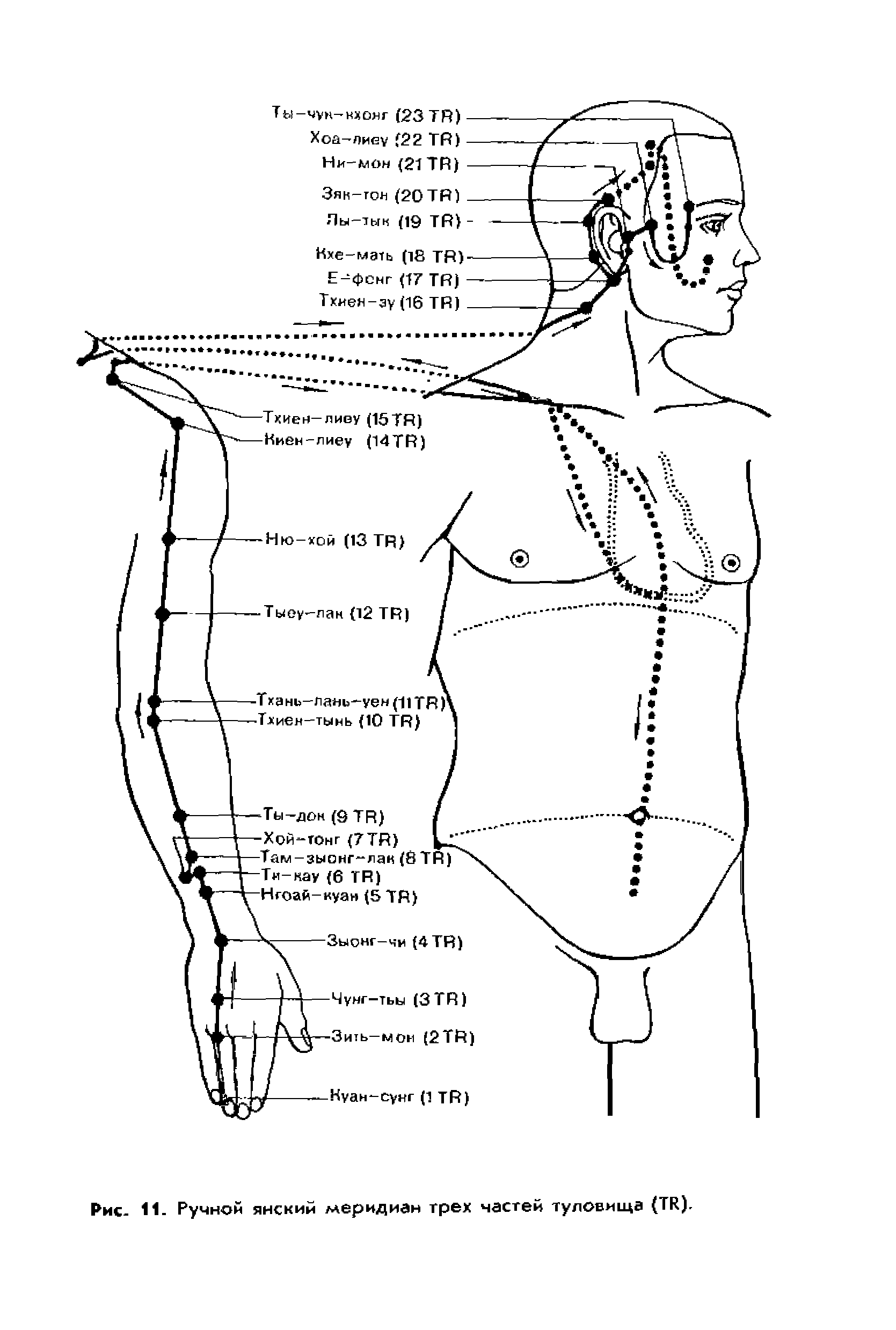 Рис. 11. Ручной янский меридиан трех частей туловища (ТИ).