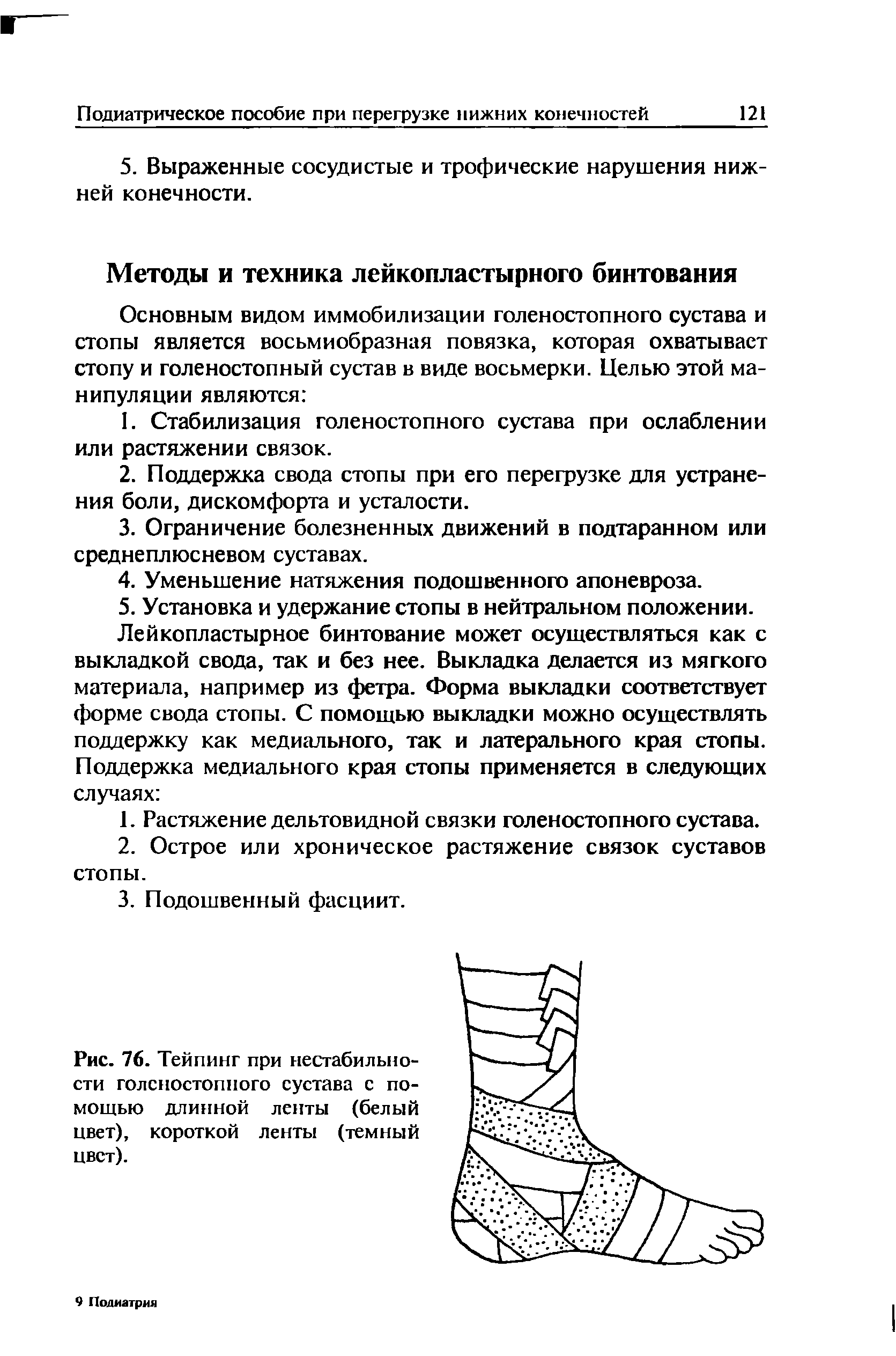 Рис. 76. Тейпинг при нестабильности голеностопного сустава с помощью длинной ленты (белый цвет), короткой ленты (темный цвет).