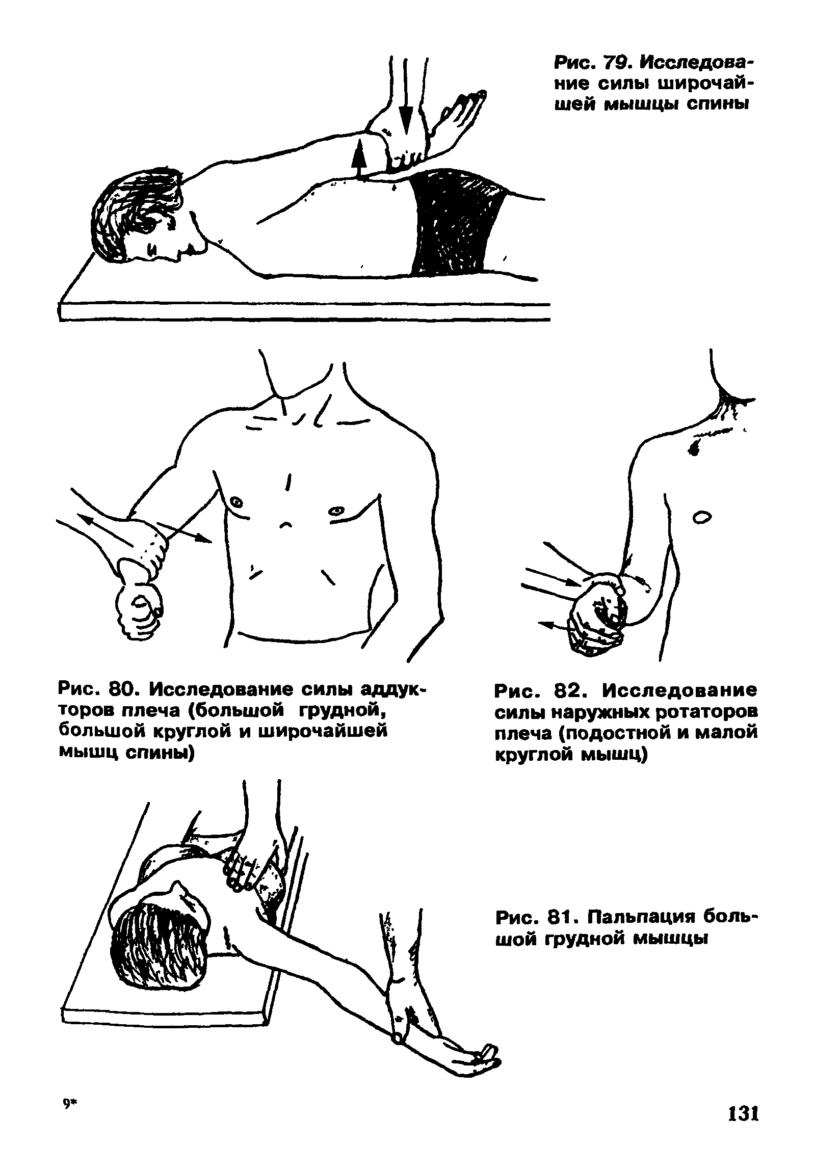Рис. 82. Исследование силы наружных ротаторов плеча (подостной и малой круглой мышц)...