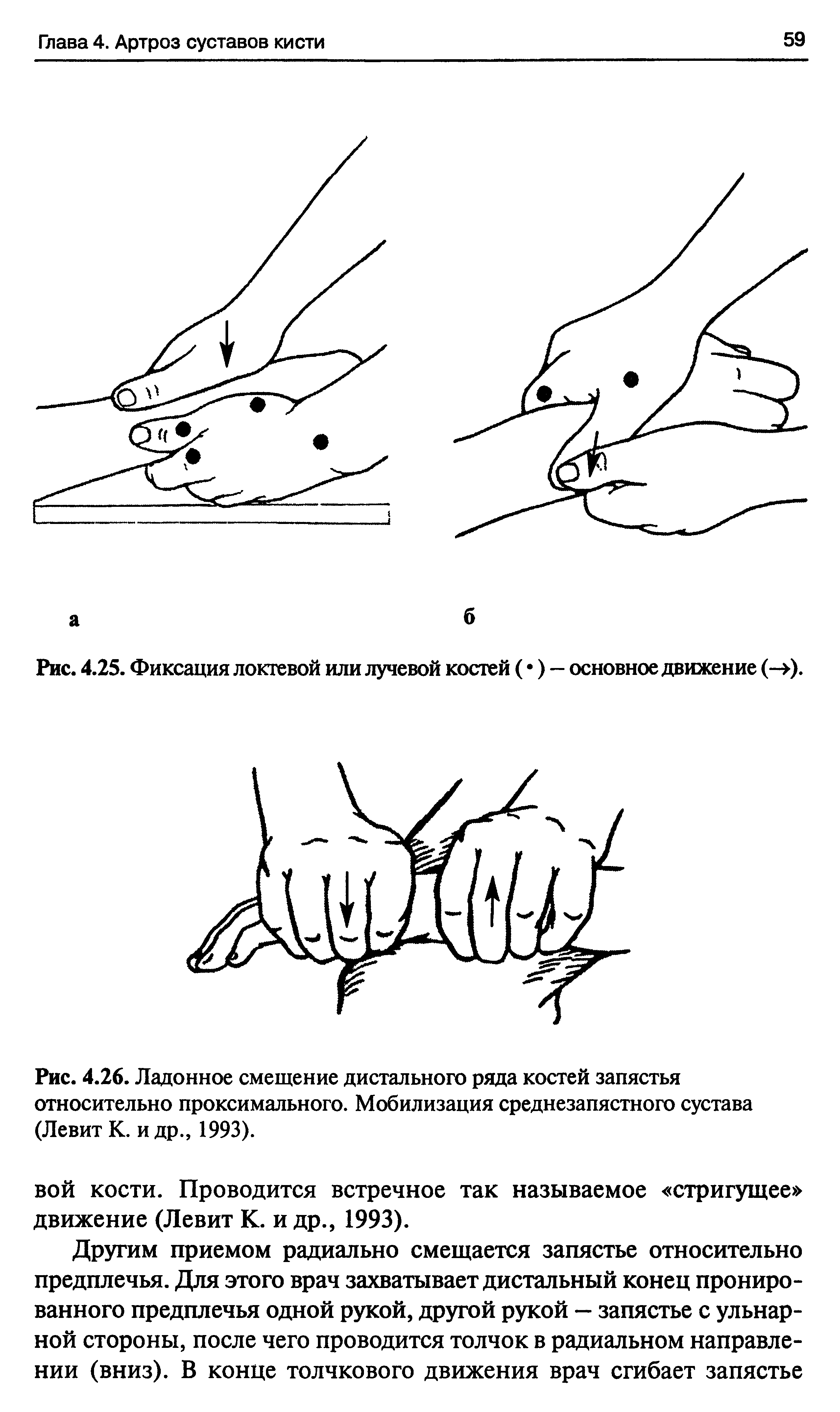 Рис. 4.25. Фиксация локтевой или лучевой костей ( ) — основное движение (->).