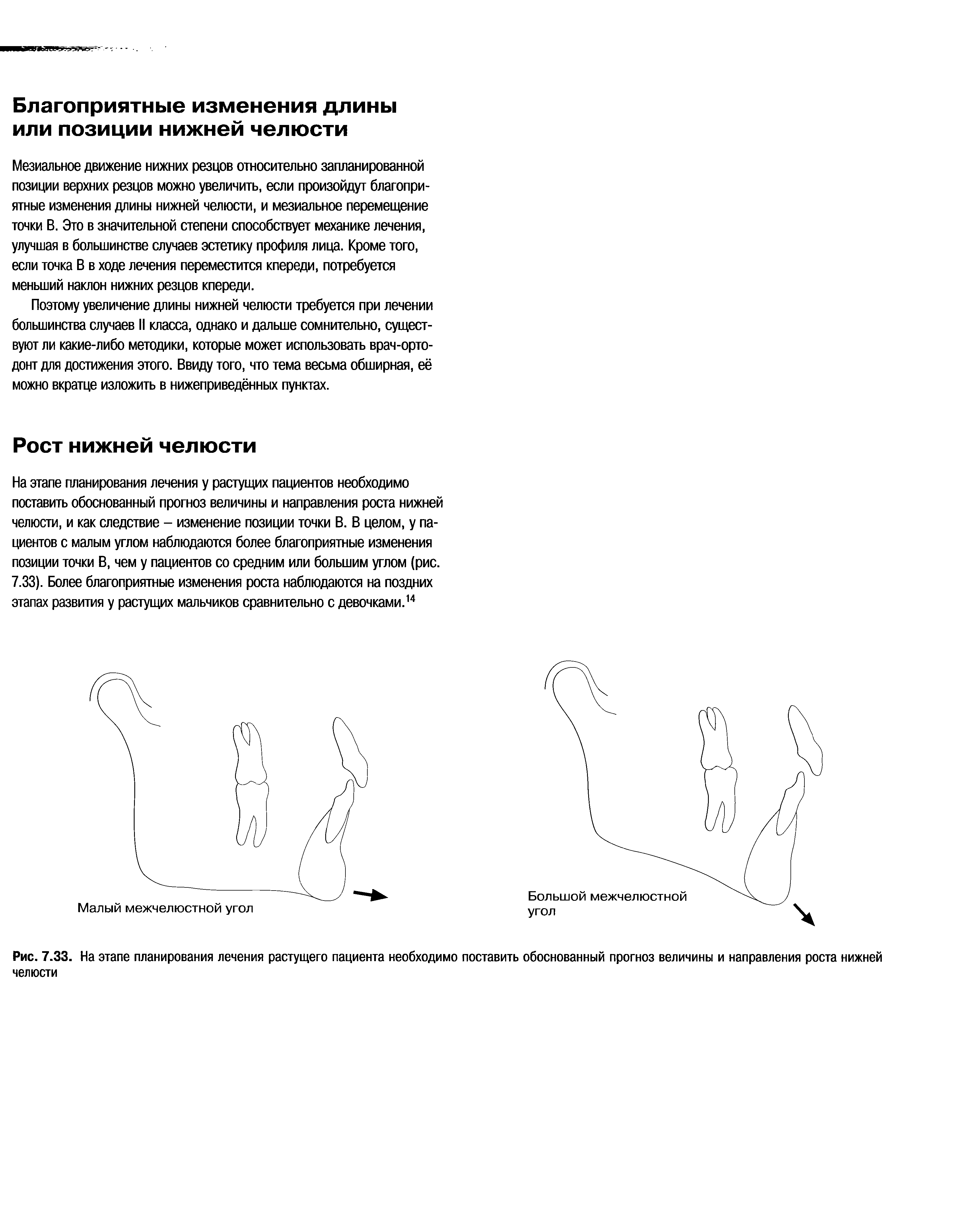 Рис. 7.33. На этапе планирования лечения растущего пациента необходимо поставить обоснованный прогноз величины и направления роста нижней челюсти...