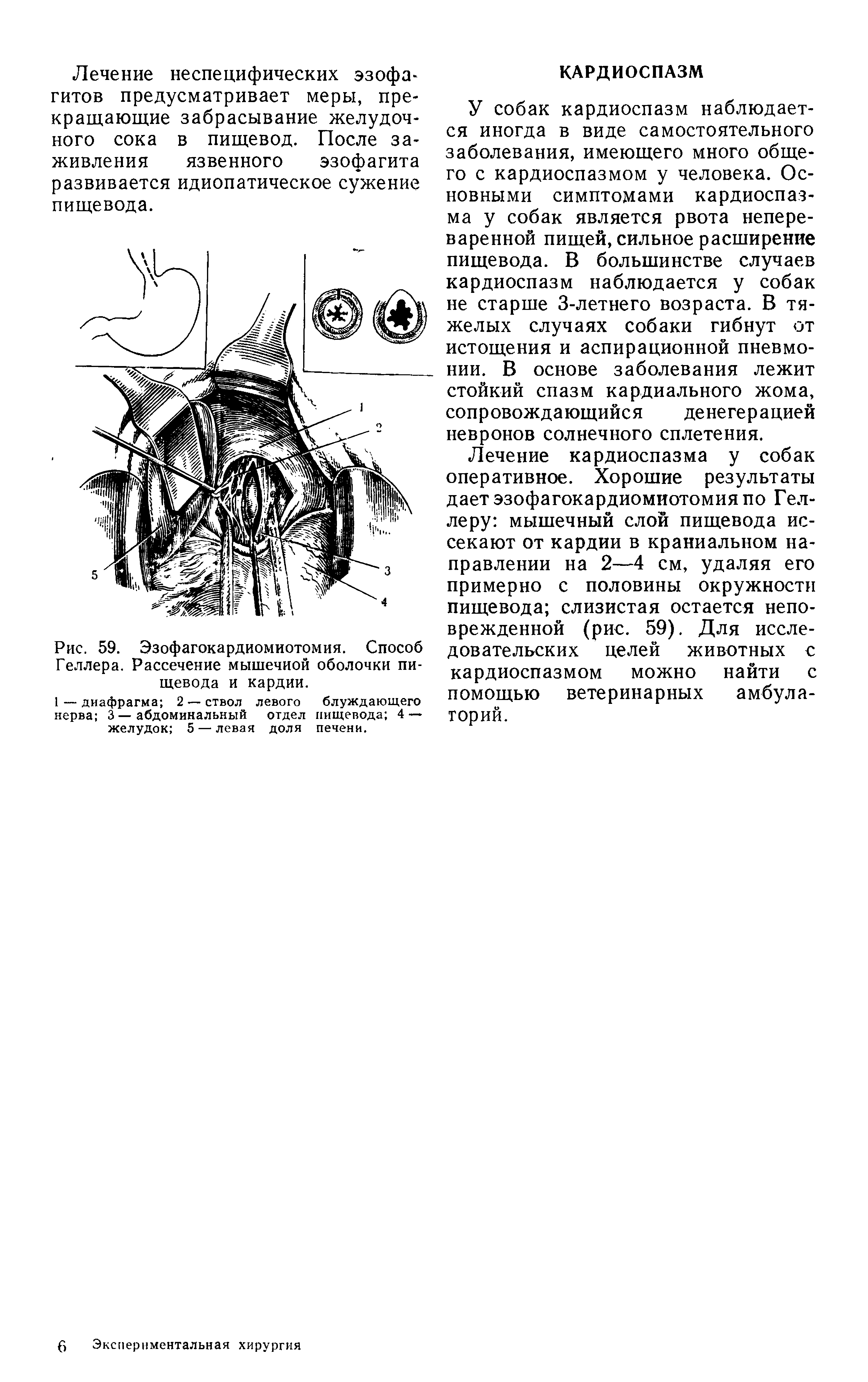 Рис. 59. Эзофагокардиомиотомия. Способ Геллера. Рассечение мышечной оболочки пищевода и кардии.