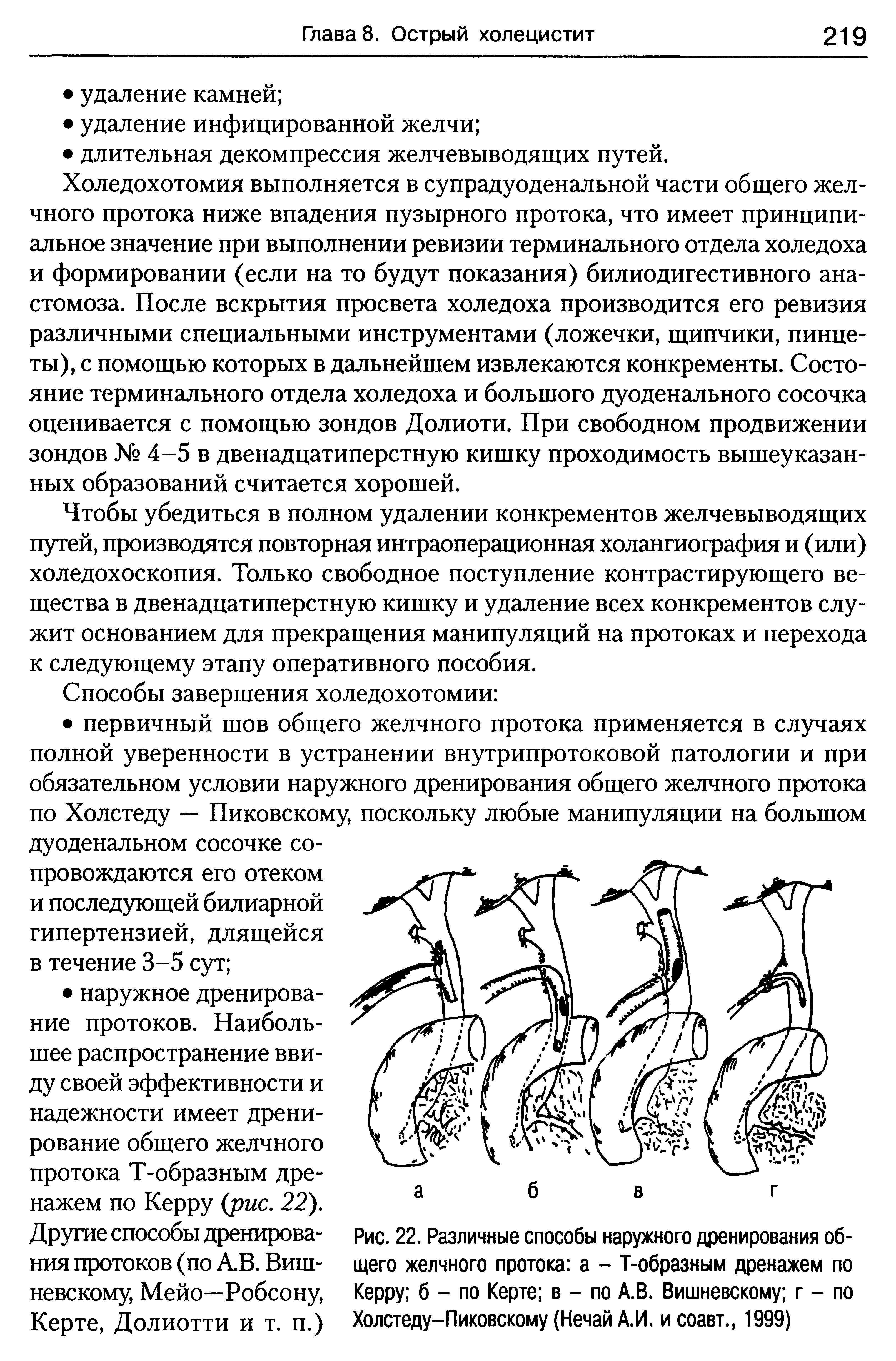 Рис. 22. Различные способы наружного дренирования общего желчного протока а - Т-образным дренажем по Керру б - по Керте в - по А.В. Вишневскому г - по Холстеду-Пиковскому (Нечай А.И. и соавт., 1999)...