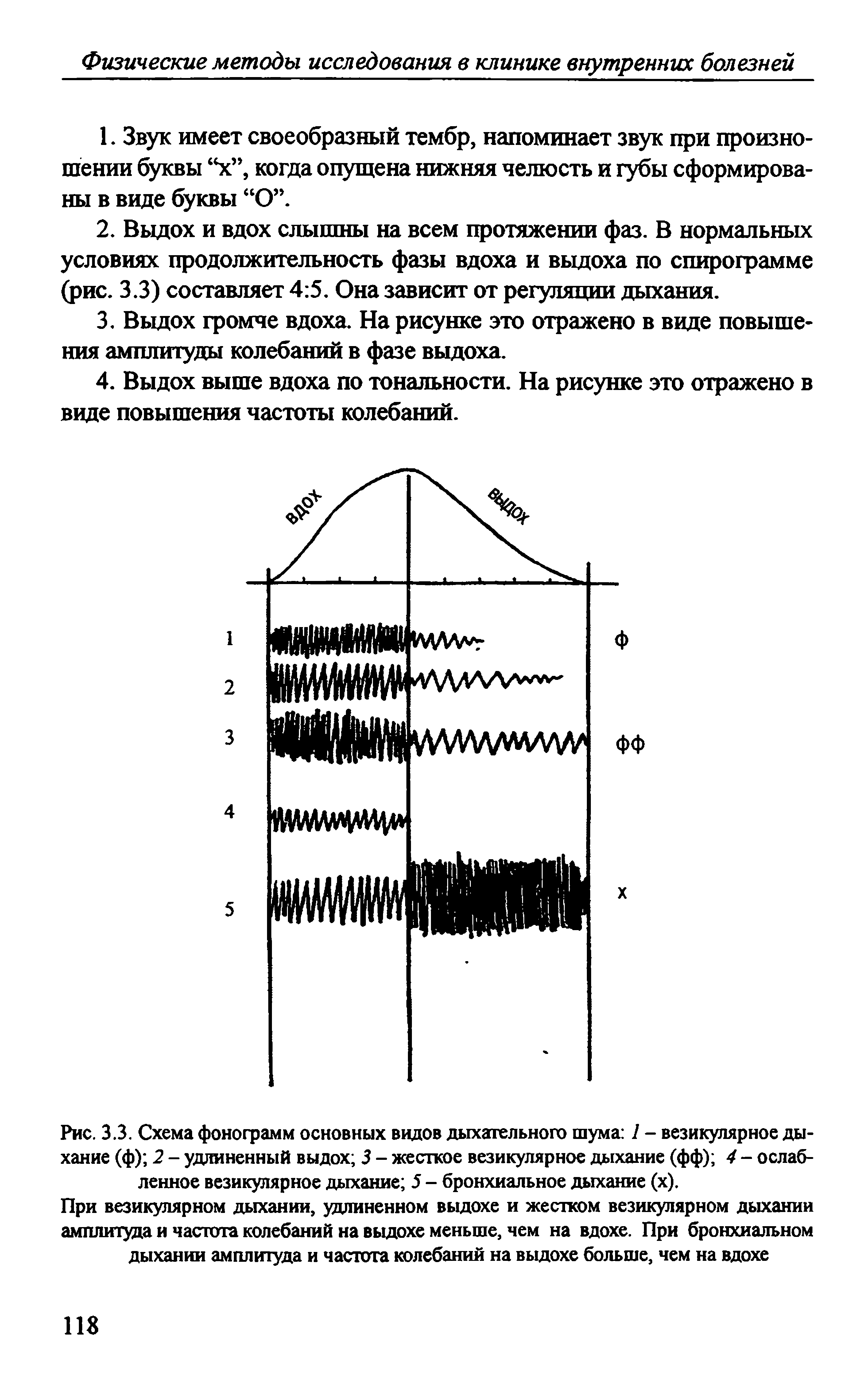 Рис. 3.3. Схема фонограмм основных видов дыхательного шума 1 - везикулярное дыхание (ф) 2 - удлиненный выдох 3 - жесткое везикулярное дыхание (фф) 4 - ослабленное везикулярное дыхание 5 - бронхиальное дыхание (х).