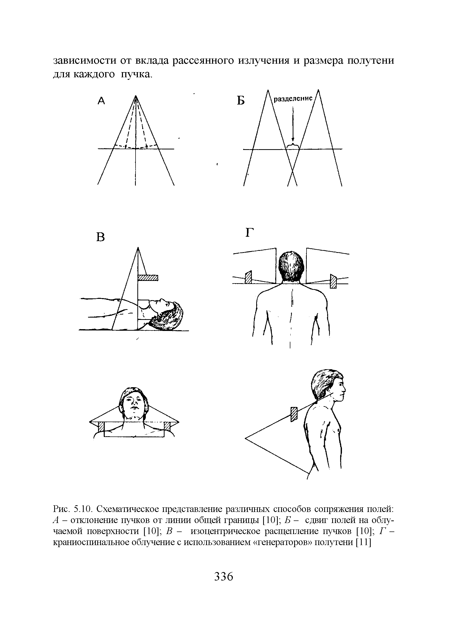Рис. 5.10. Схематическое представление различных способов сопряжения полей А - отклонение пучков от линии общей границы [10] Б - сдвиг полей на облучаемой поверхности [10] В - изоцентрическое расщепление пучков [10] Г -краниоспинальное облучение с использованием генераторов полутени [11]...