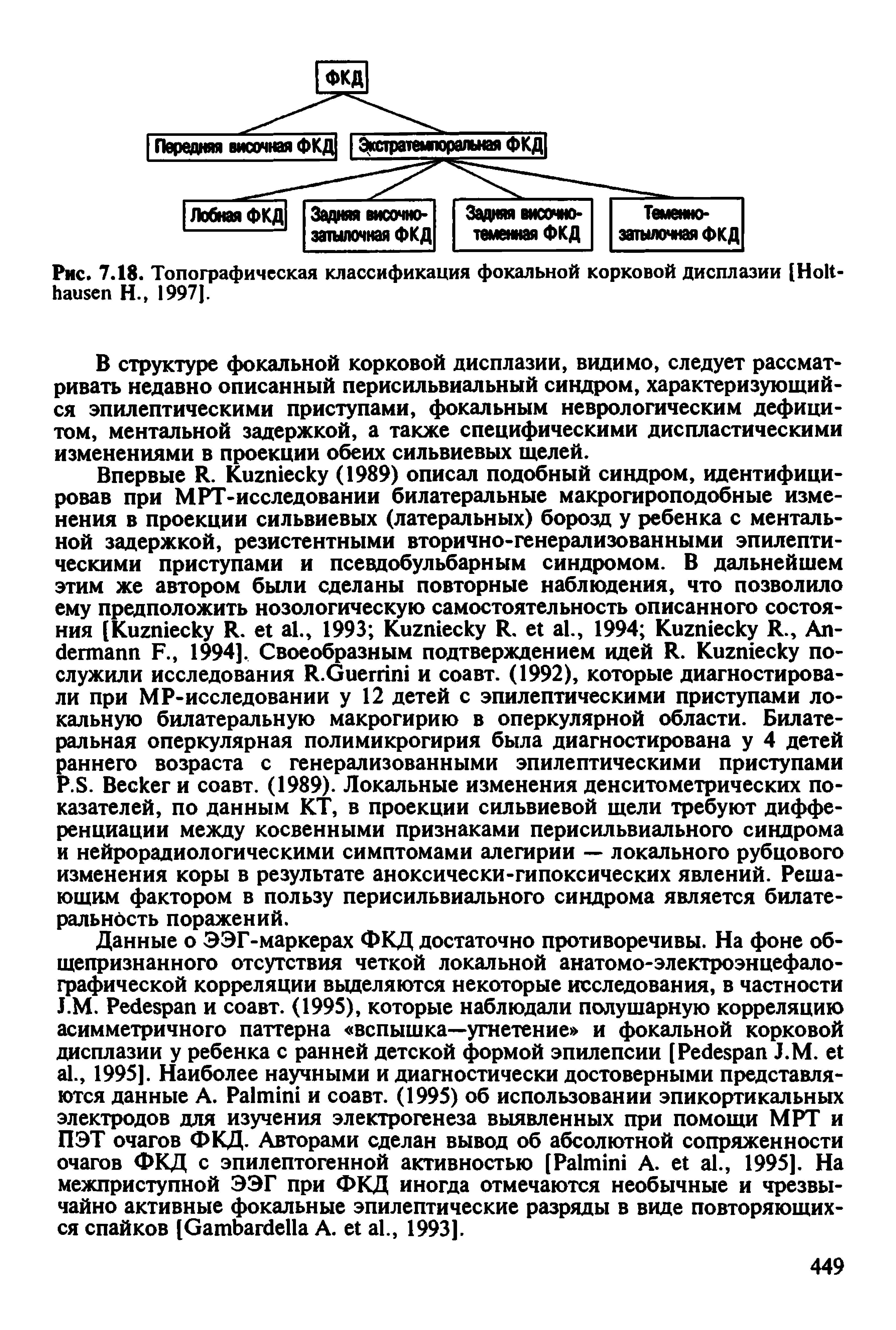 Рис. 7.18. Топографическая классификация фокальной корковой дисплазии [H Н., 1997J.