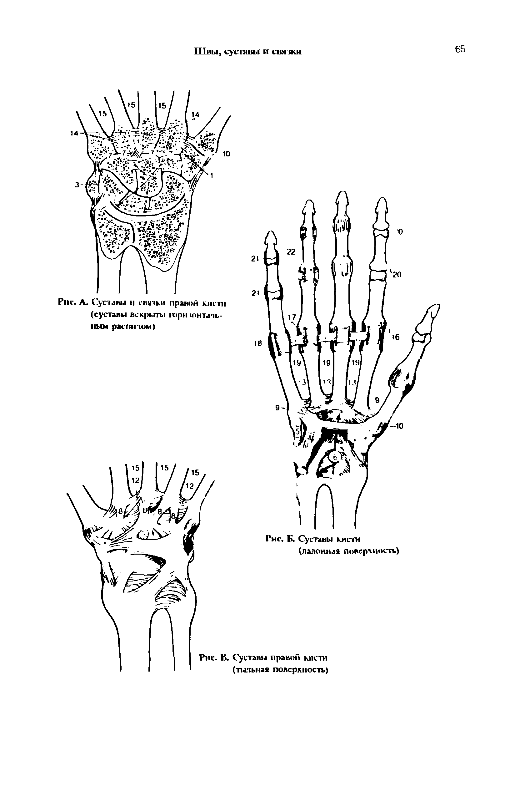 Рис. А. (уставы н связки правой кист (суставы вскрьпы гори юнтать-...