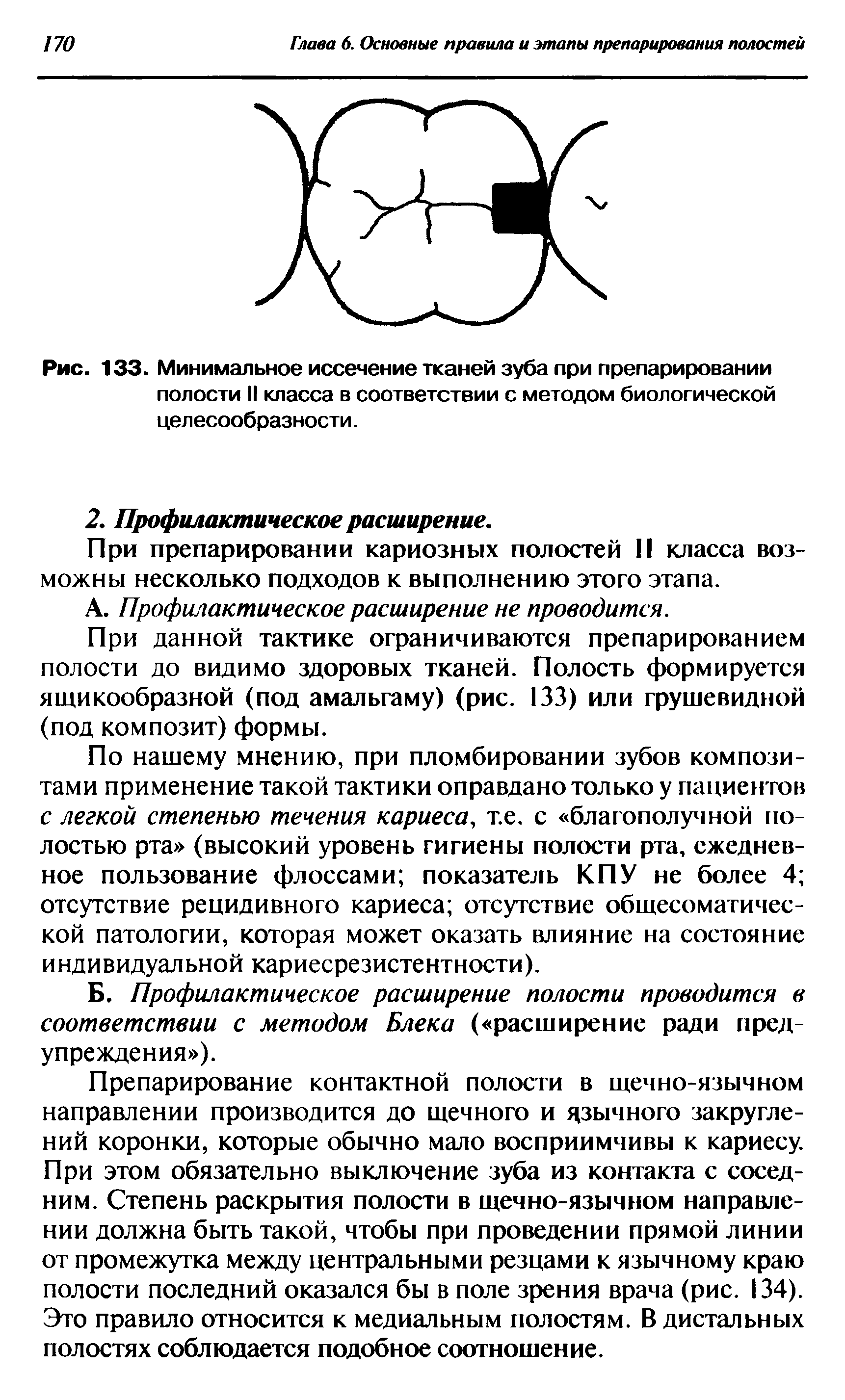 Рис. 133. Минимальное иссечение тканей зуба при препарировании полости II класса в соответствии с методом биологической целесообразности.