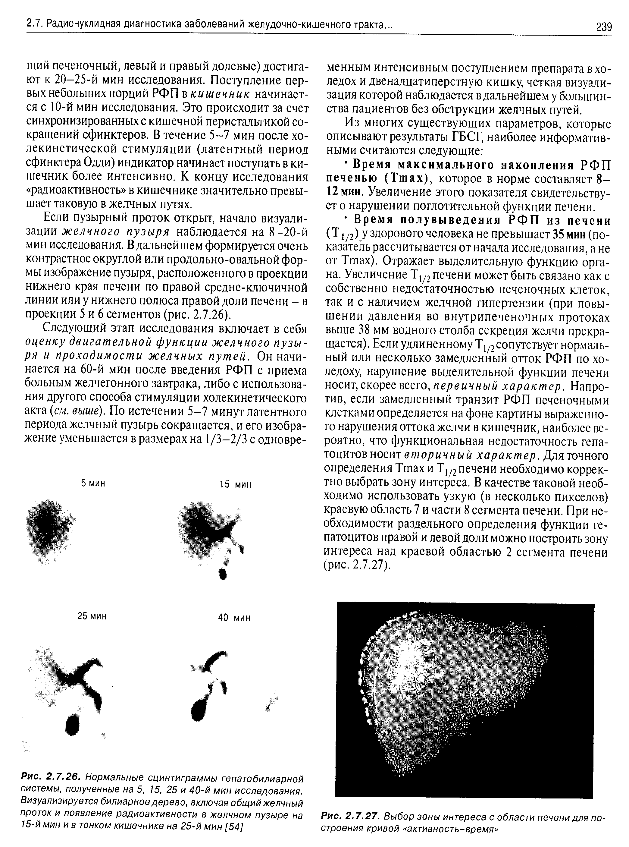 Рис. 2.7.26. Нормальные сцинтиграммы гепатобилиарной системы, полученные на 5, 15, 25 и 40-й мин исследования. Визуализируется билиарное дерево, включая общий желчный проток и появление радиоактивности в желчном пузыре на 15-й мин и в тонком кишечнике на 25-й мин [54]...