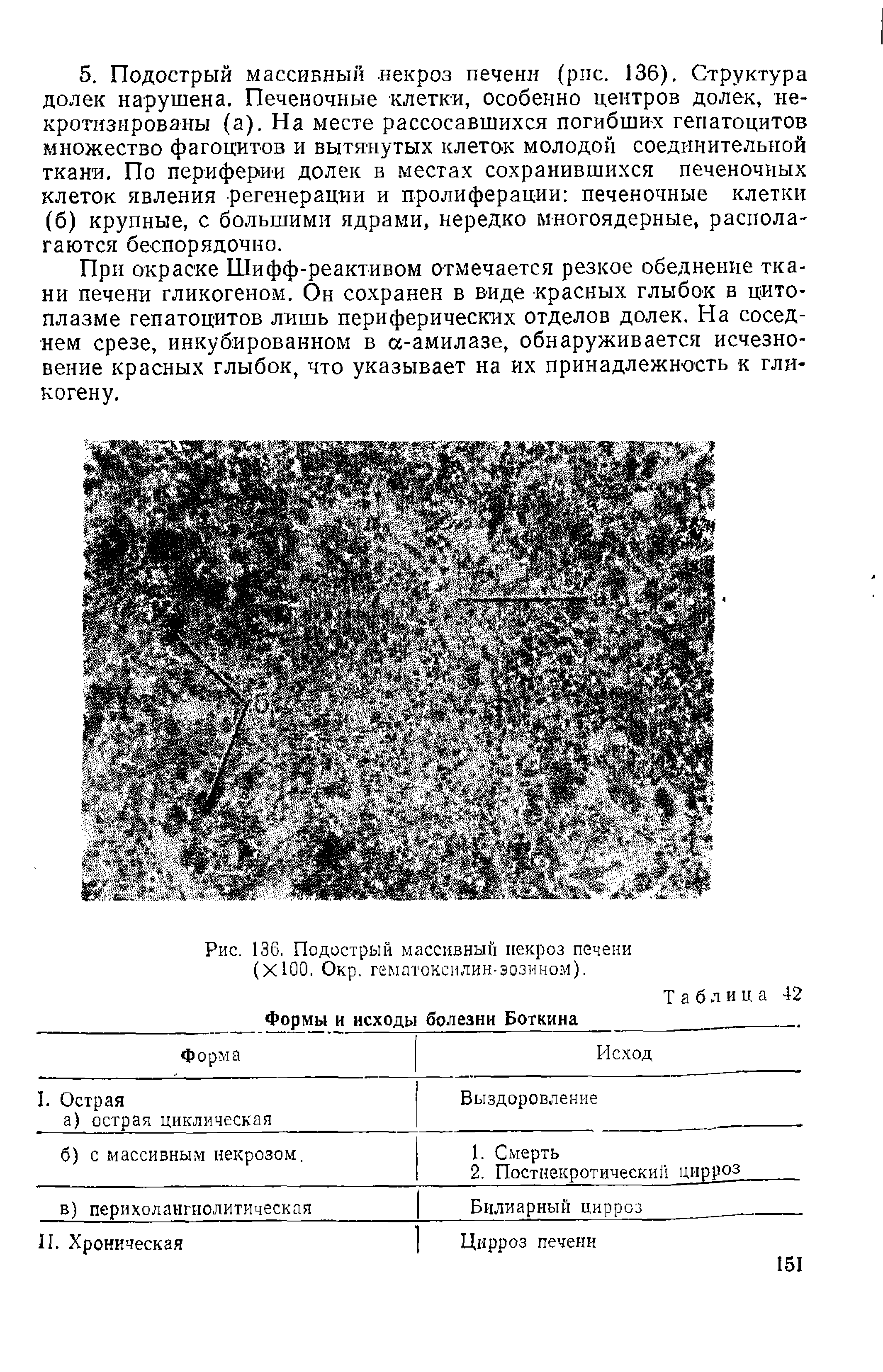 Рис. 136. Подострый массивный некроз печени (ХЮО. Окр. гематоксилин-эозином).