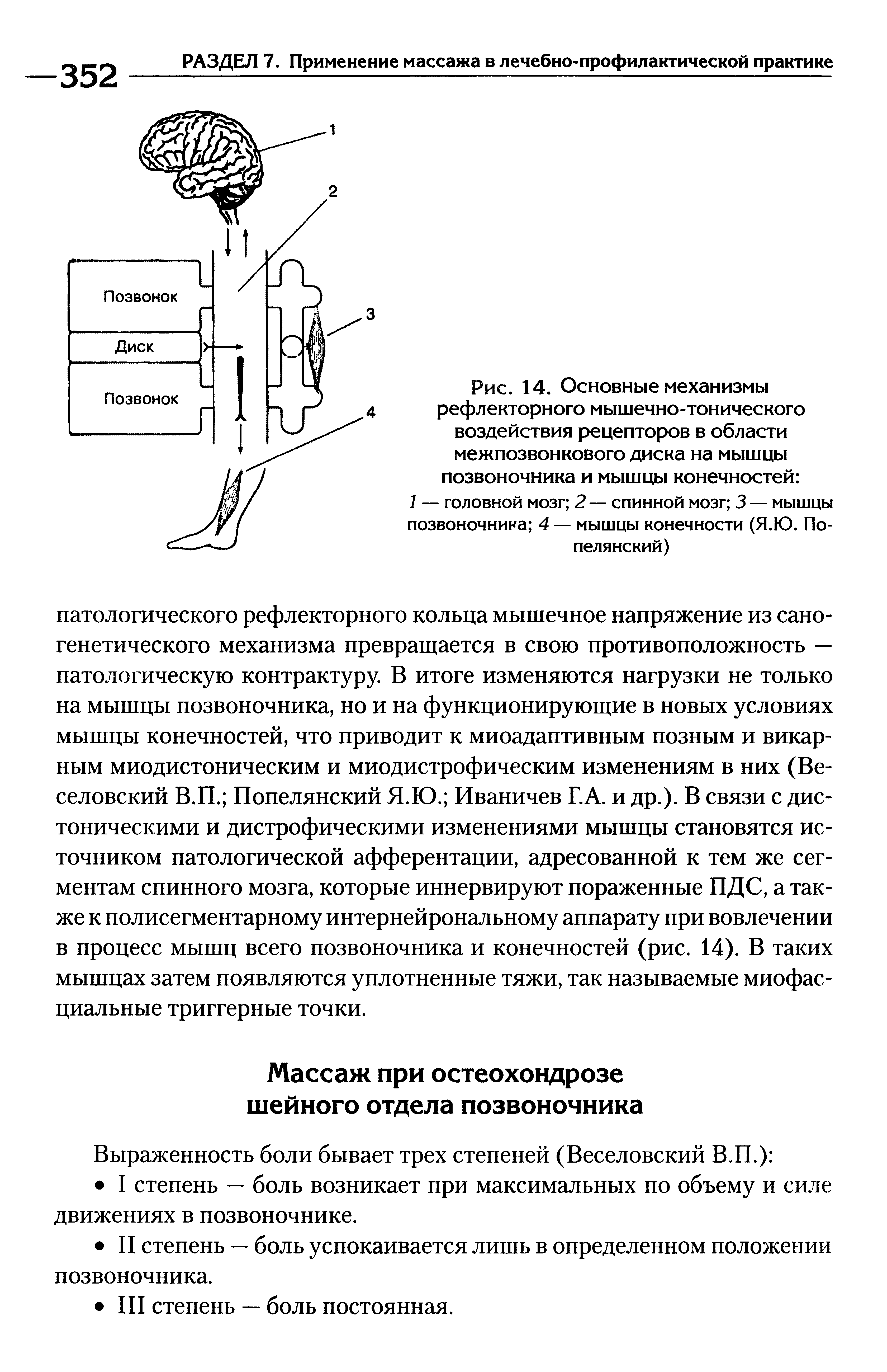 Рис. 14. Основные механизмы рефлекторного мышечно-тонического воздействия рецепторов в области межпозвонкового диска на мышцы позвоночника и мышцы конечностей ...