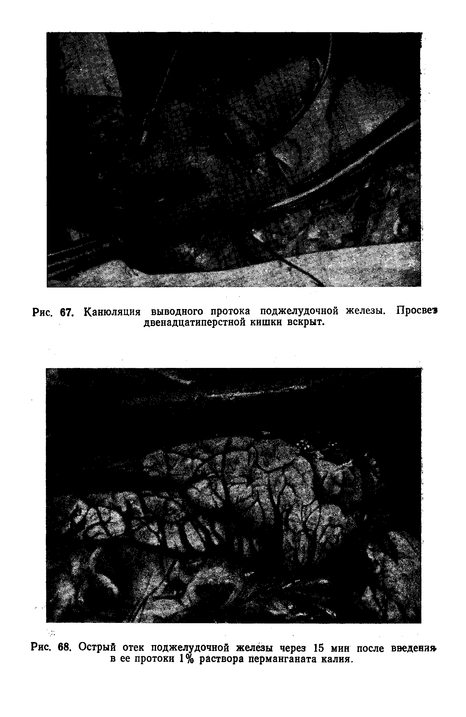 Рис. 68. Острый отек поджелудочной железы через 15 мин после введения в ее протоки 1% раствора перманганата калия.