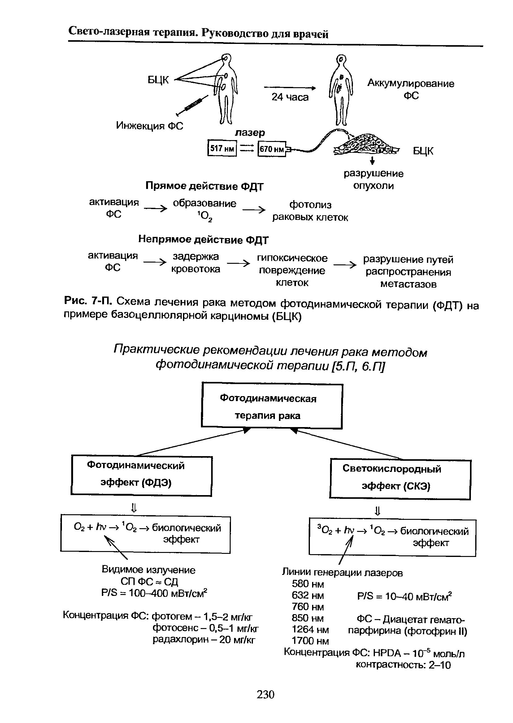 Рис. 7-П. Схема лечения рака методом фотодинамической терапии (ФДТ) на примере базоцеллюлярной карциномы (БЦК)...